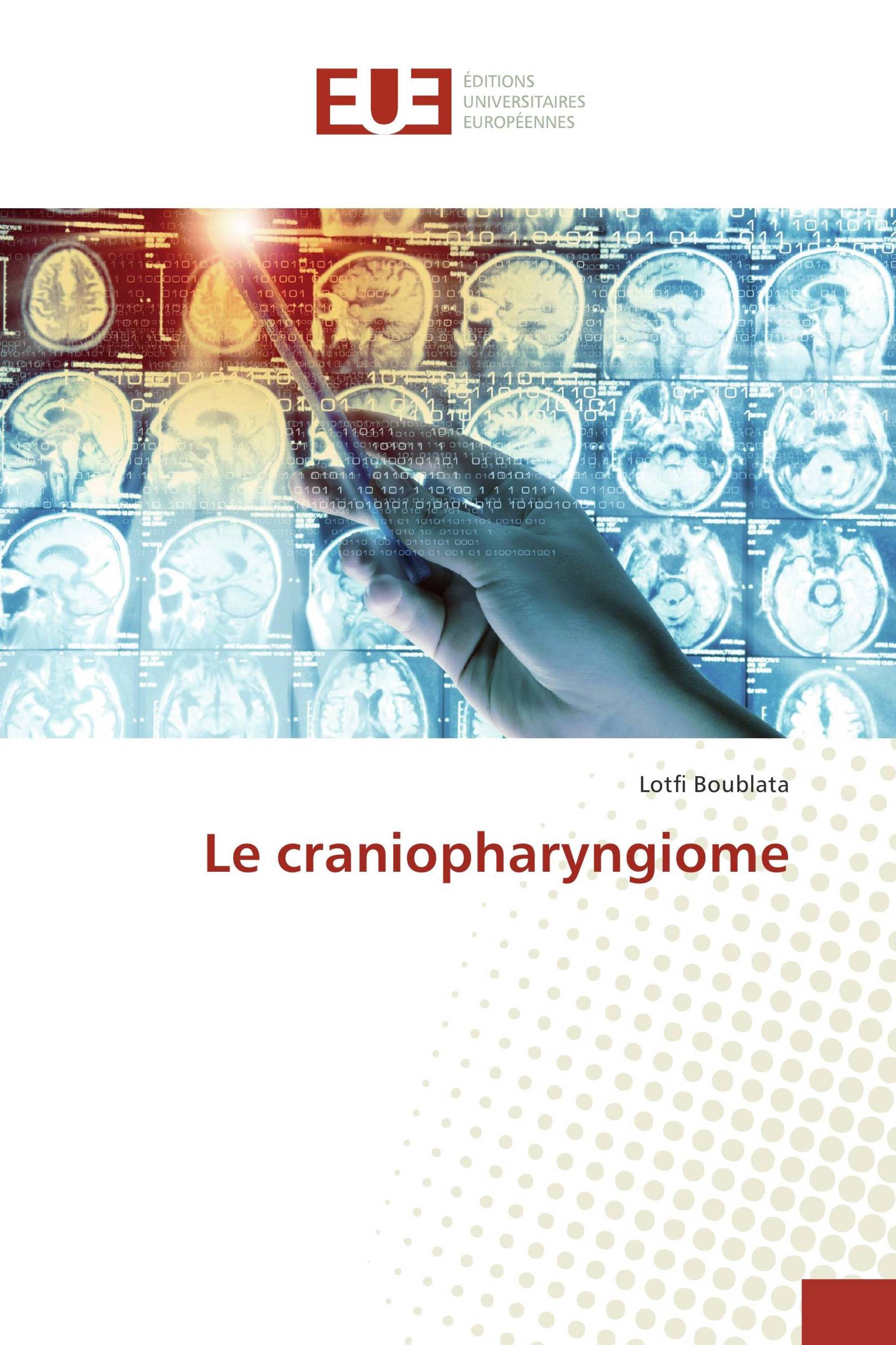 Le craniopharyngiome