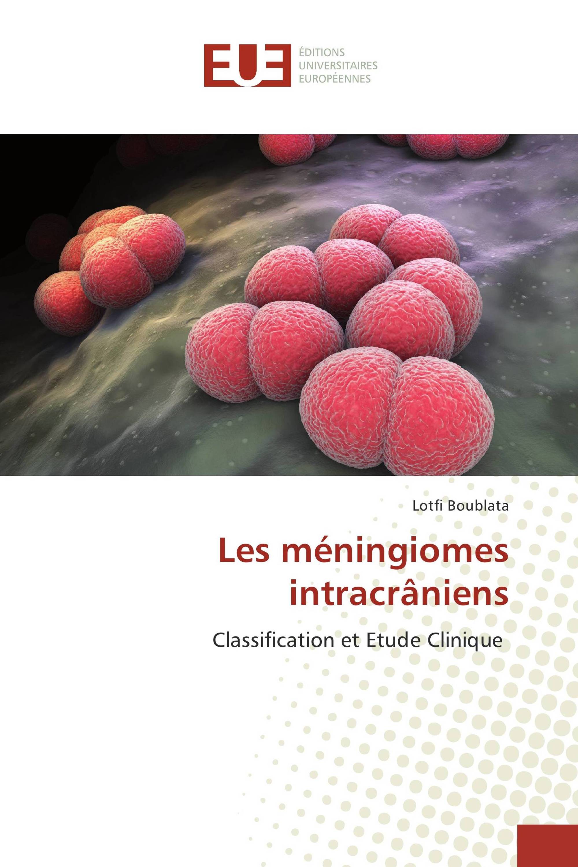 Les méningiomes intracrâniens