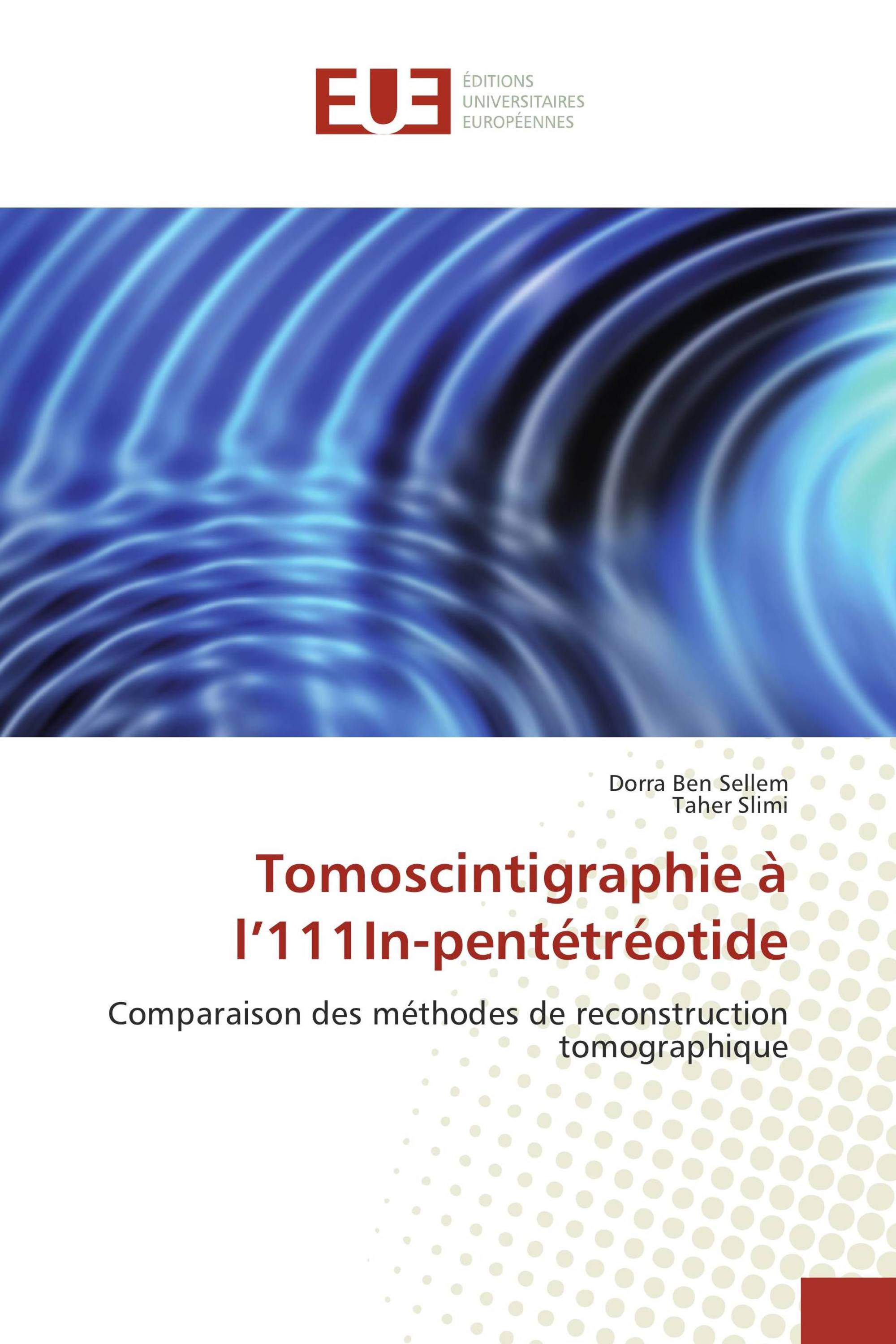 Tomoscintigraphie à l’111In-pentétréotide