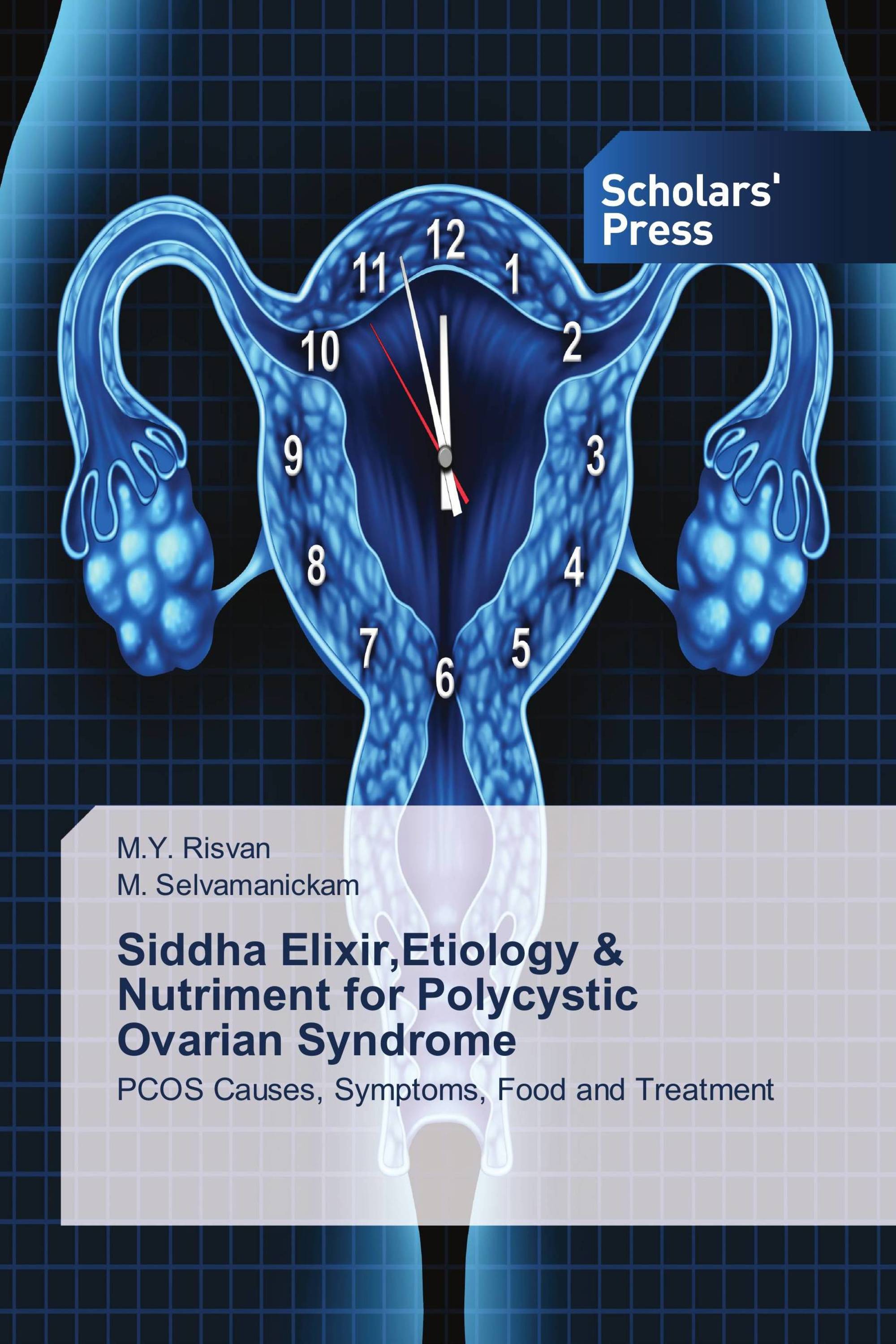 Siddha Elixir,Etiology & Nutriment for Polycystic Ovarian Syndrome