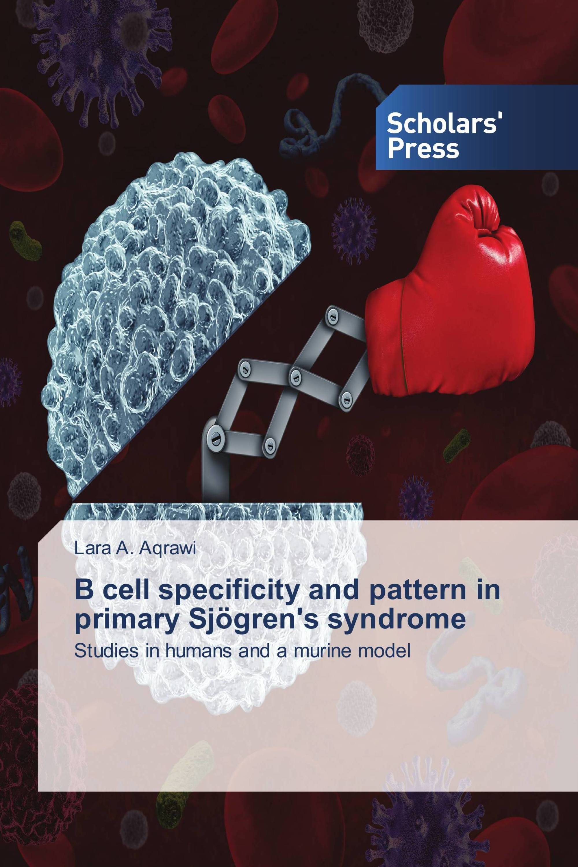 B cell specificity and pattern in primary Sjögren's syndrome