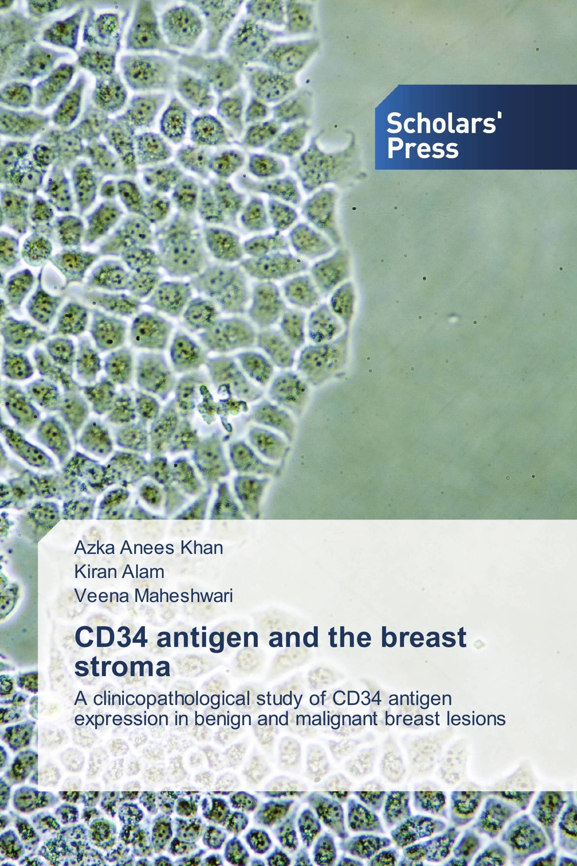 CD34 antigen and the breast stroma