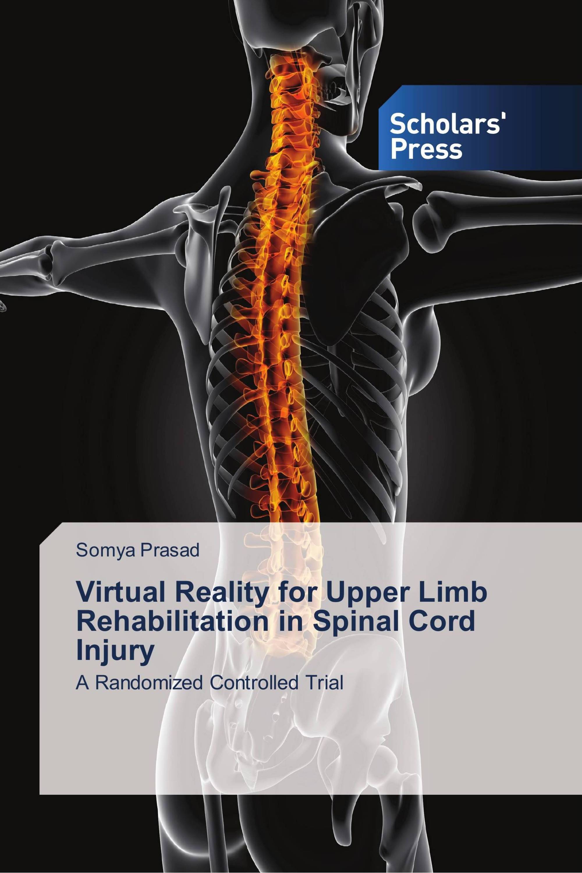 Virtual Reality for Upper Limb Rehabilitation in Spinal Cord Injury