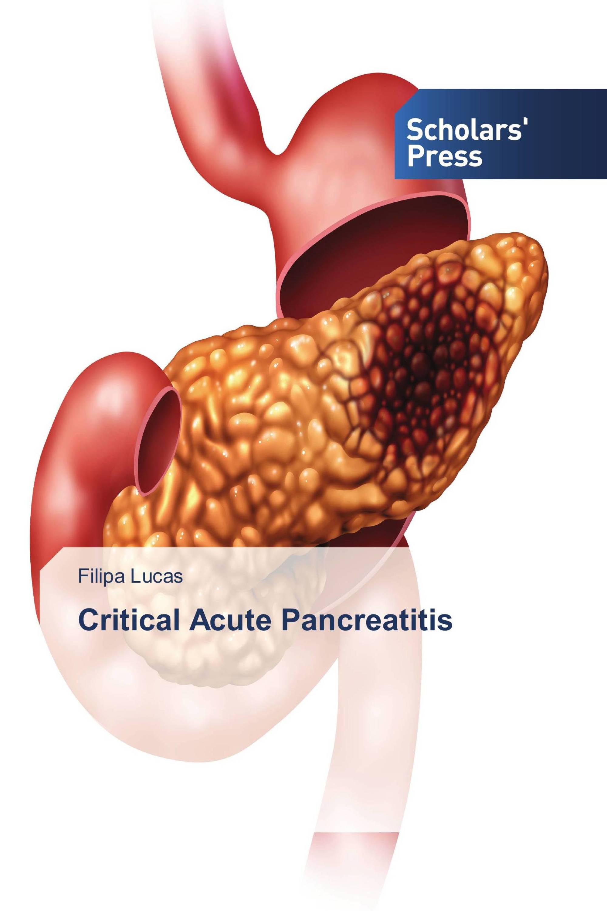 Critical Acute Pancreatitis