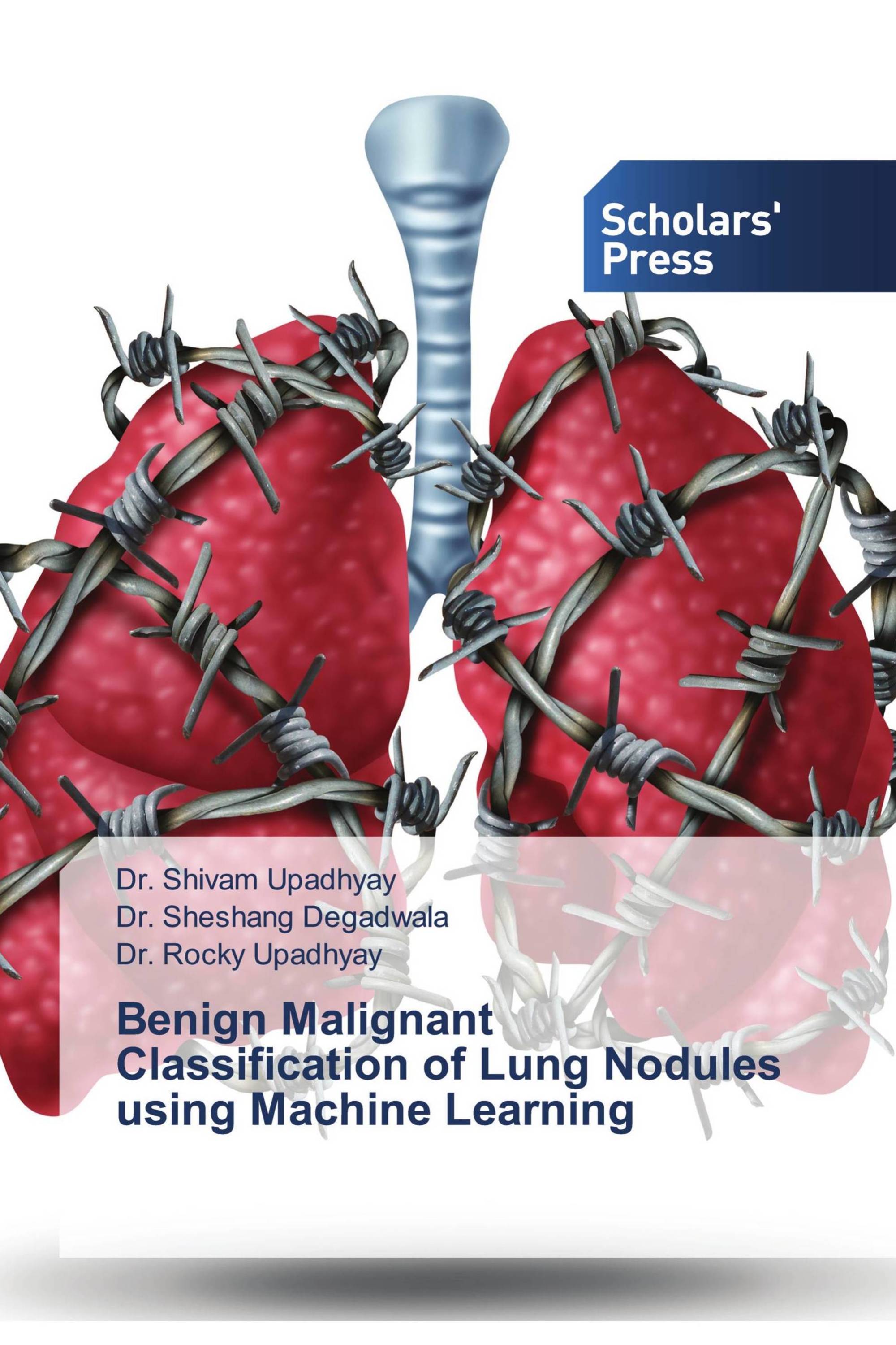 Benign Malignant Classification of Lung Nodules using Machine Learning