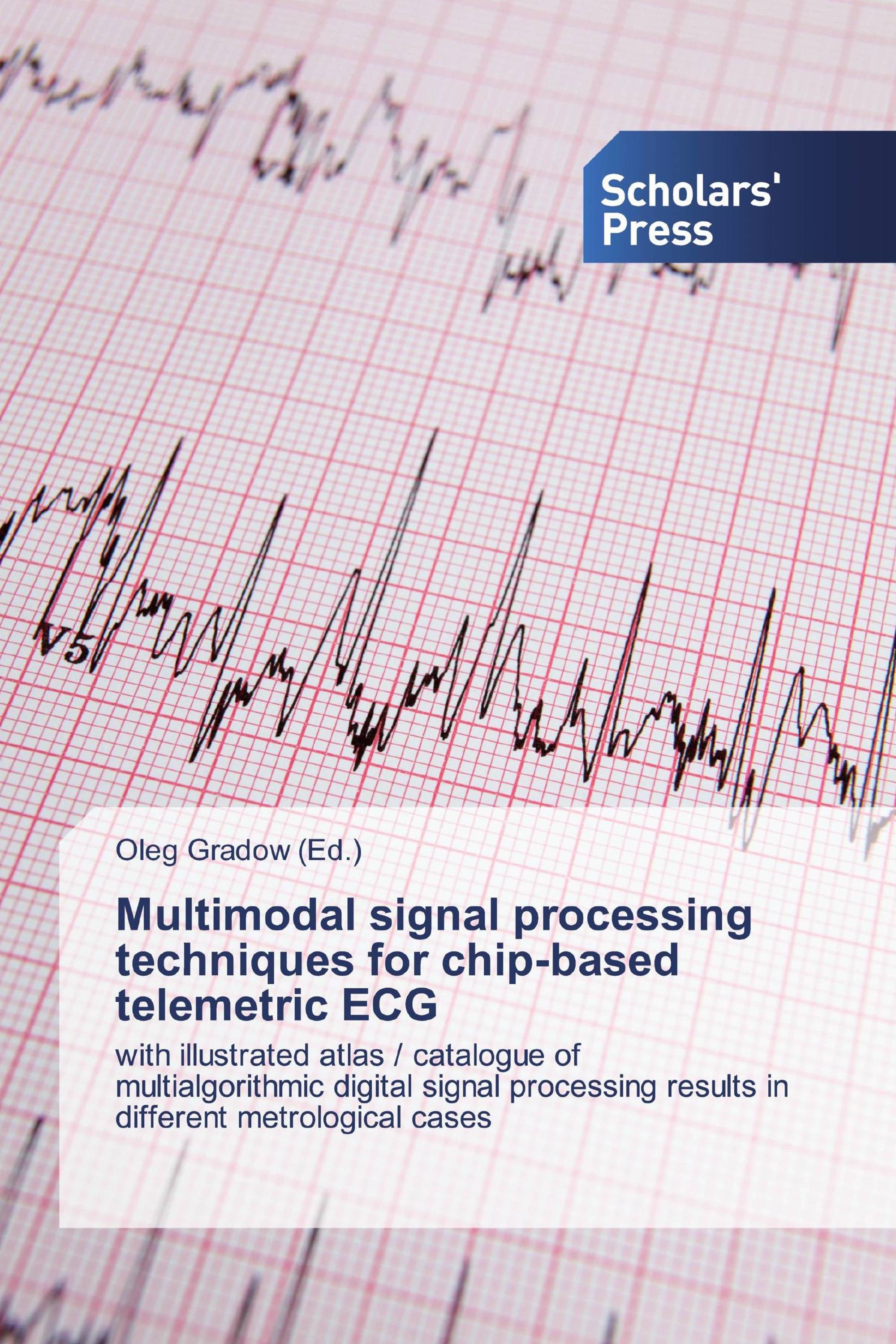 Multimodal signal processing techniques for chip-based telemetric ECG