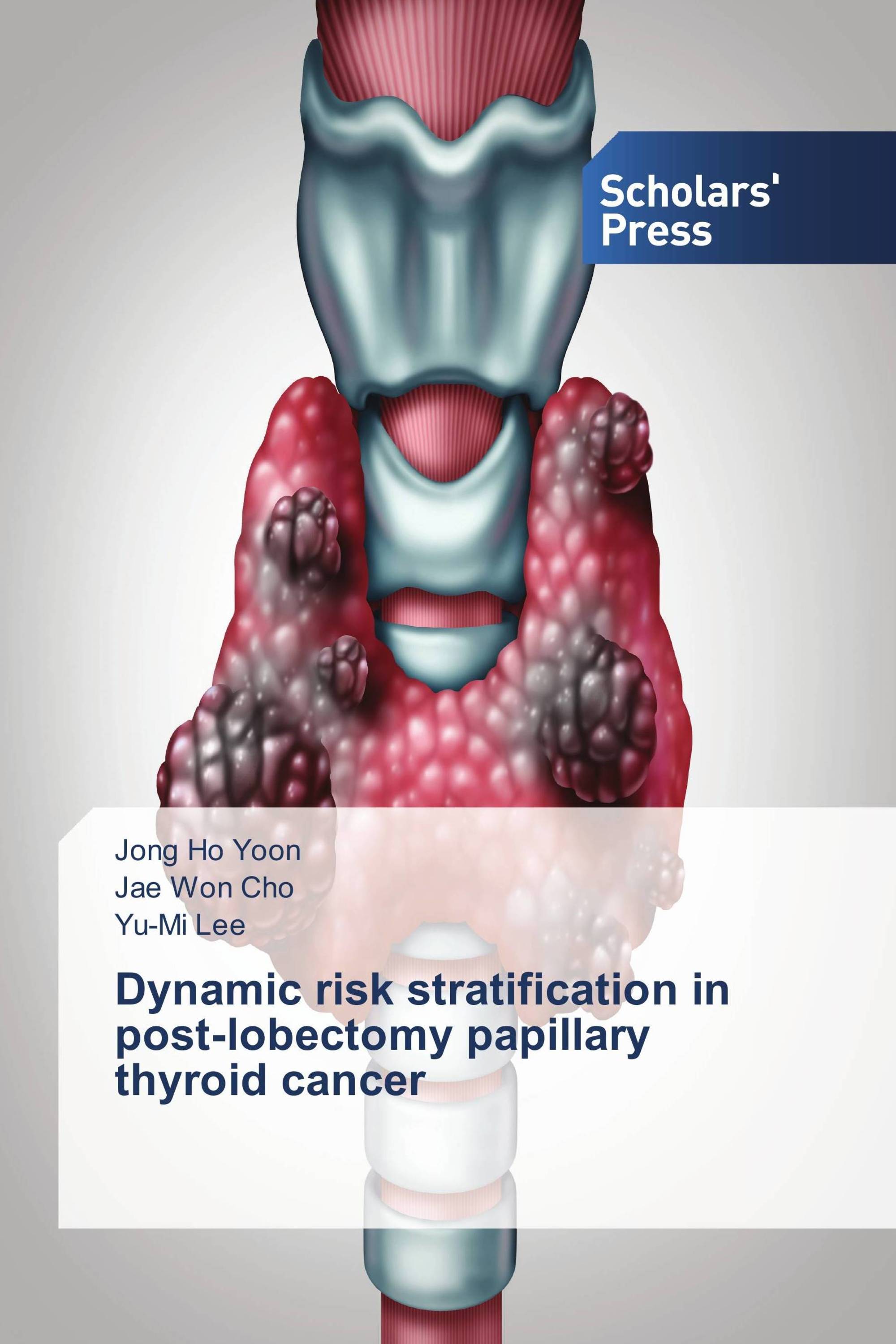 Dynamic risk stratification in post-lobectomy papillary thyroid cancer