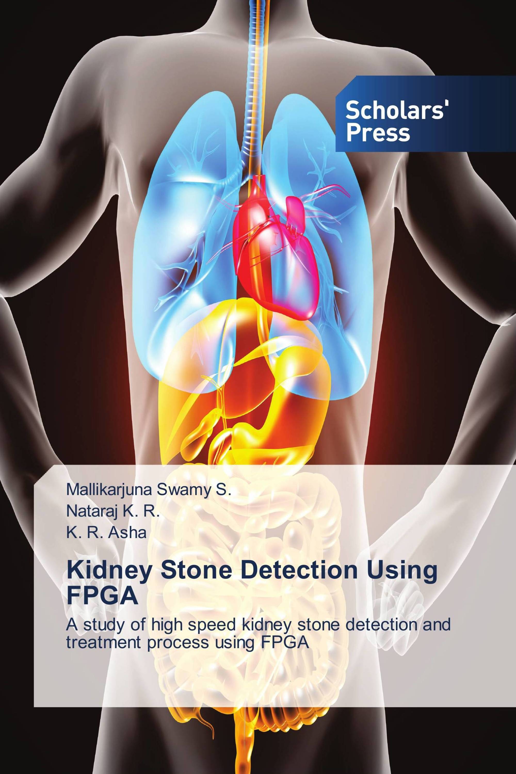 Kidney Stone Detection Using FPGA