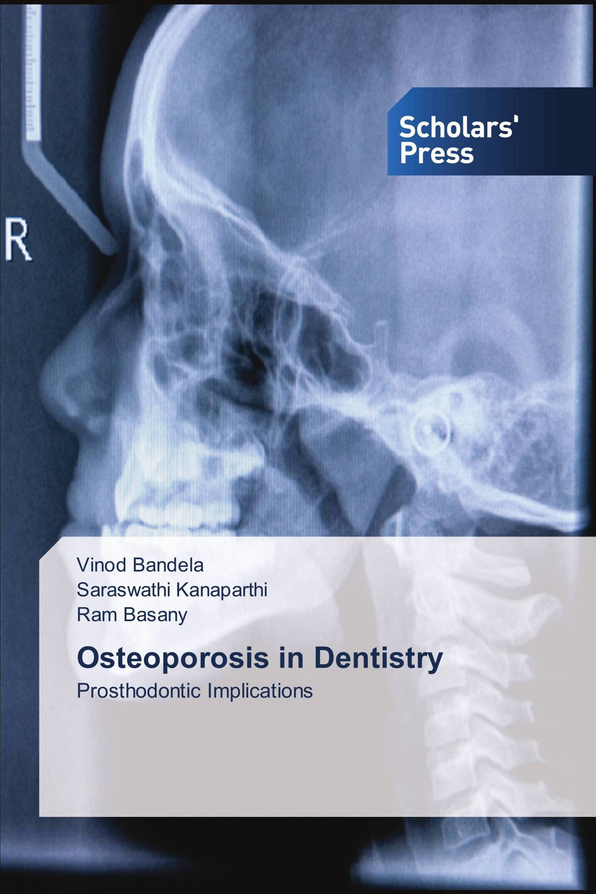 Osteoporosis in Dentistry