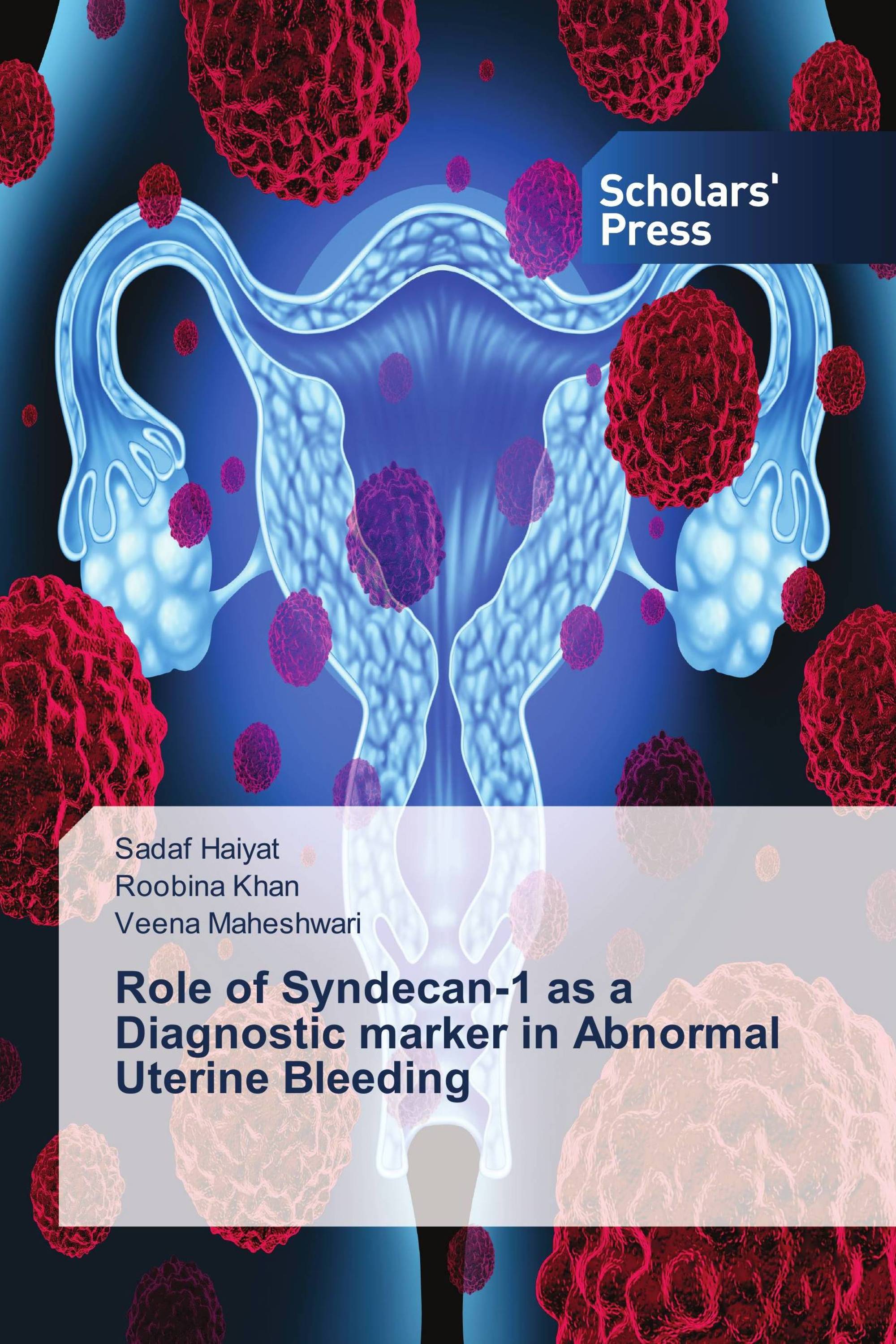 Role of Syndecan-1 as a Diagnostic marker in Abnormal Uterine Bleeding