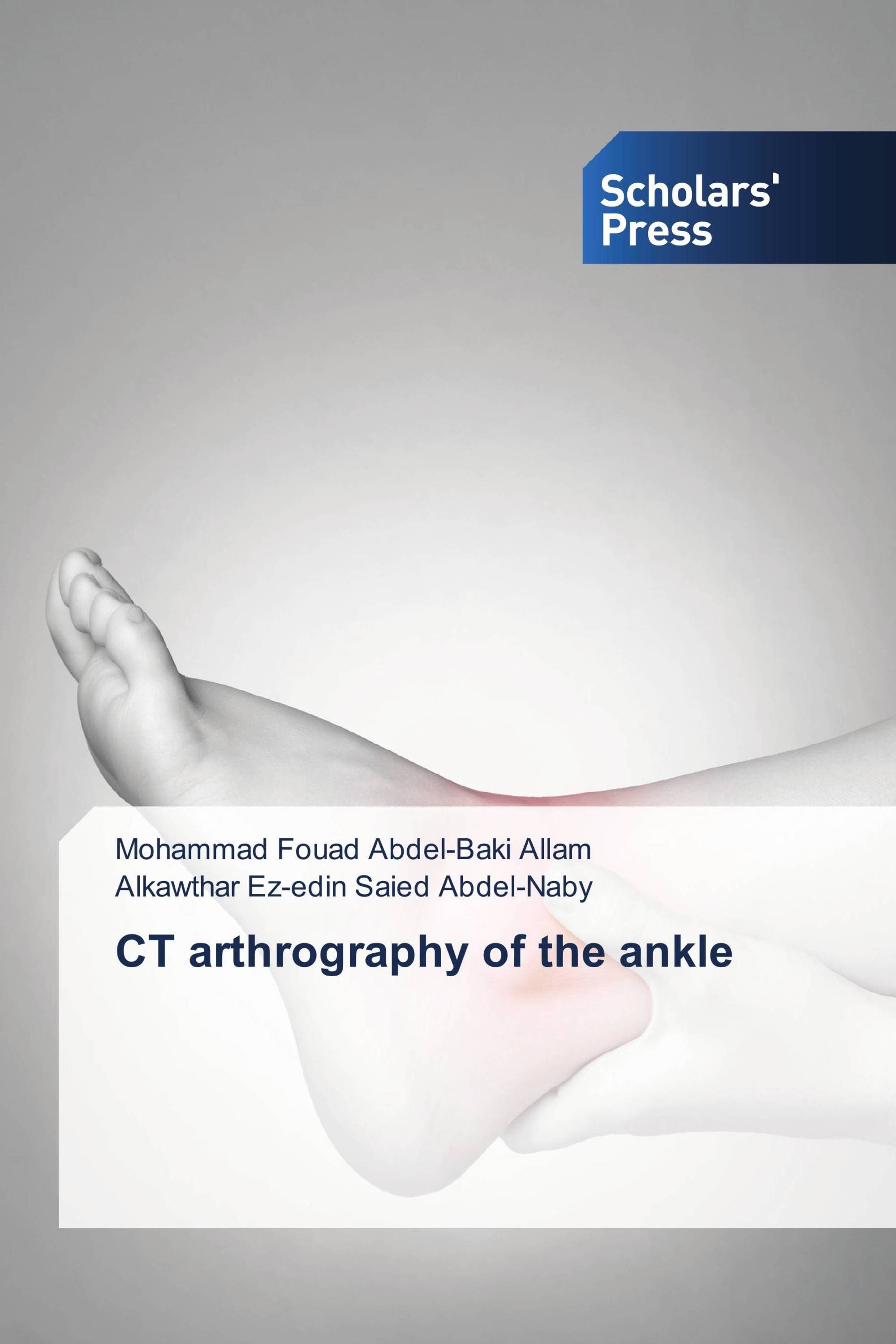 CT arthrography of the ankle