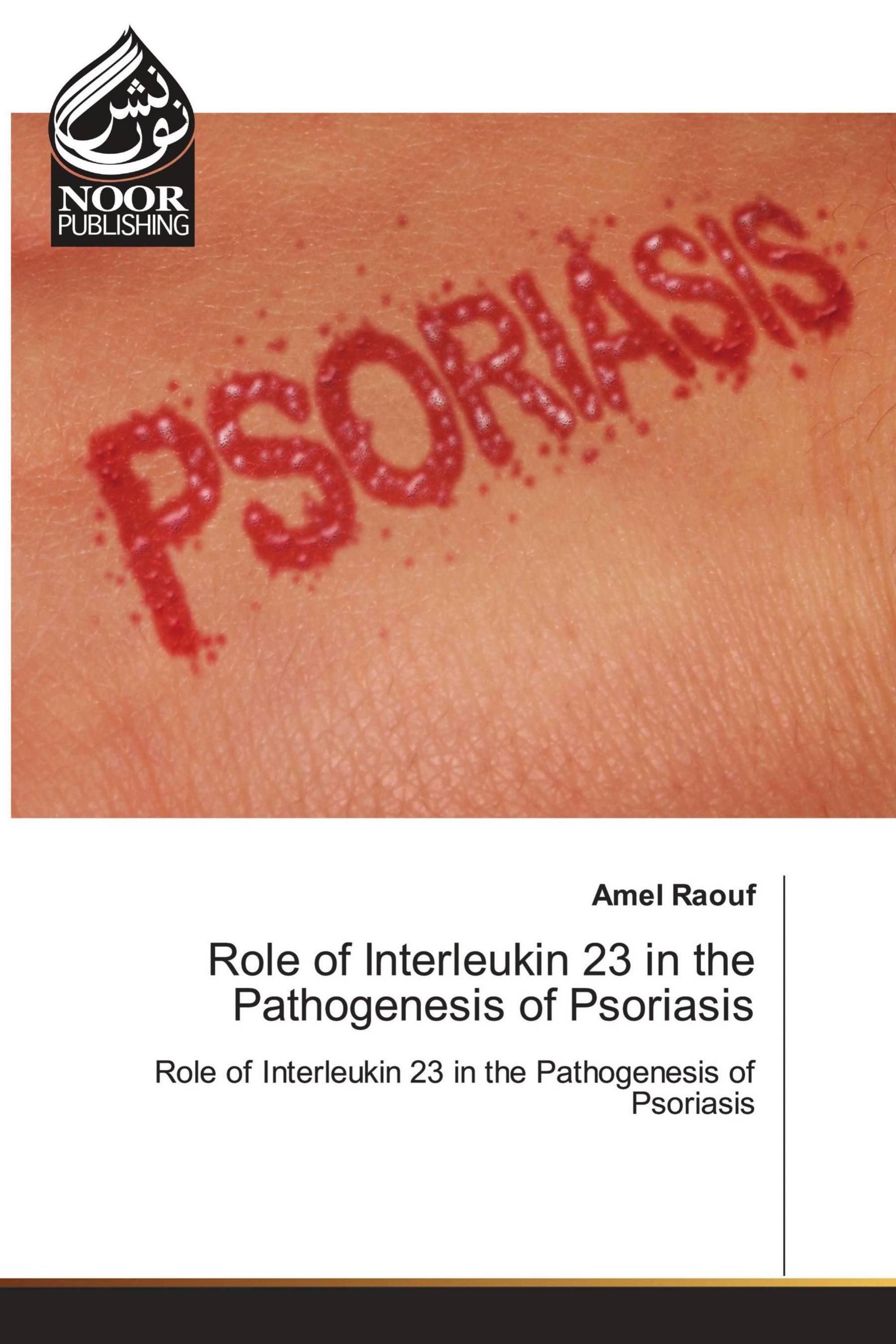 Role of Interleukin 23 in the Pathogenesis of Psoriasis