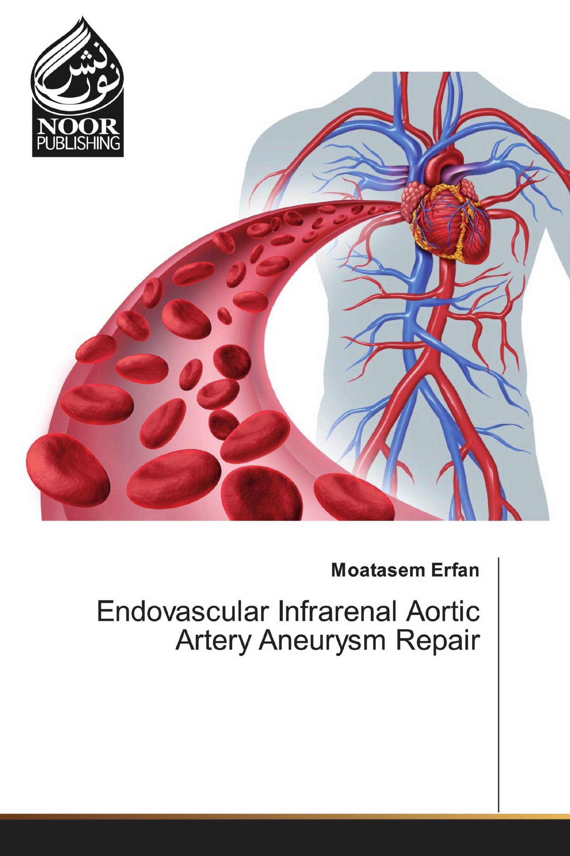 Endovascular Infrarenal Aortic Artery Aneurysm Repair