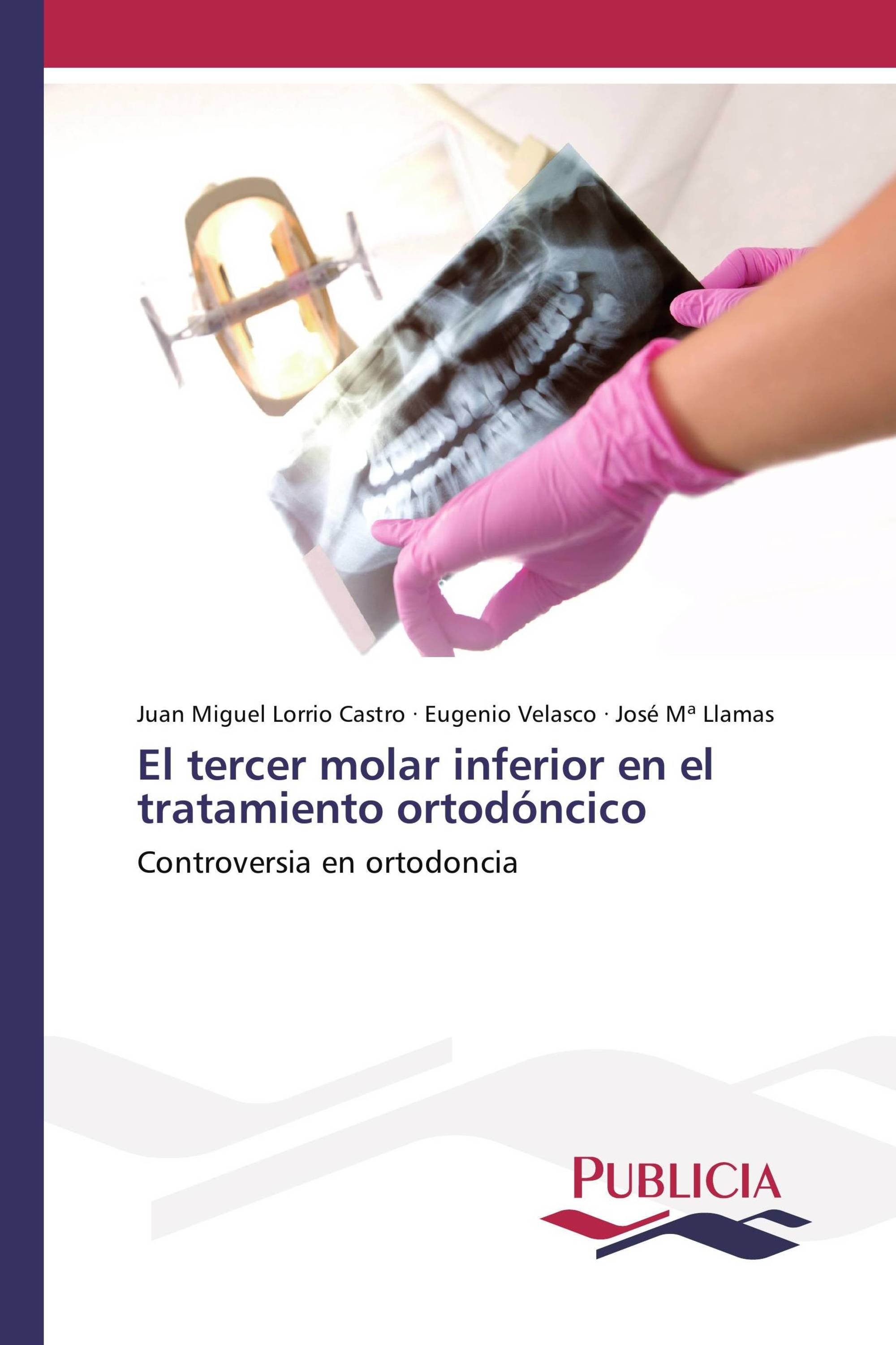 El tercer molar inferior en el tratamiento ortodóncico