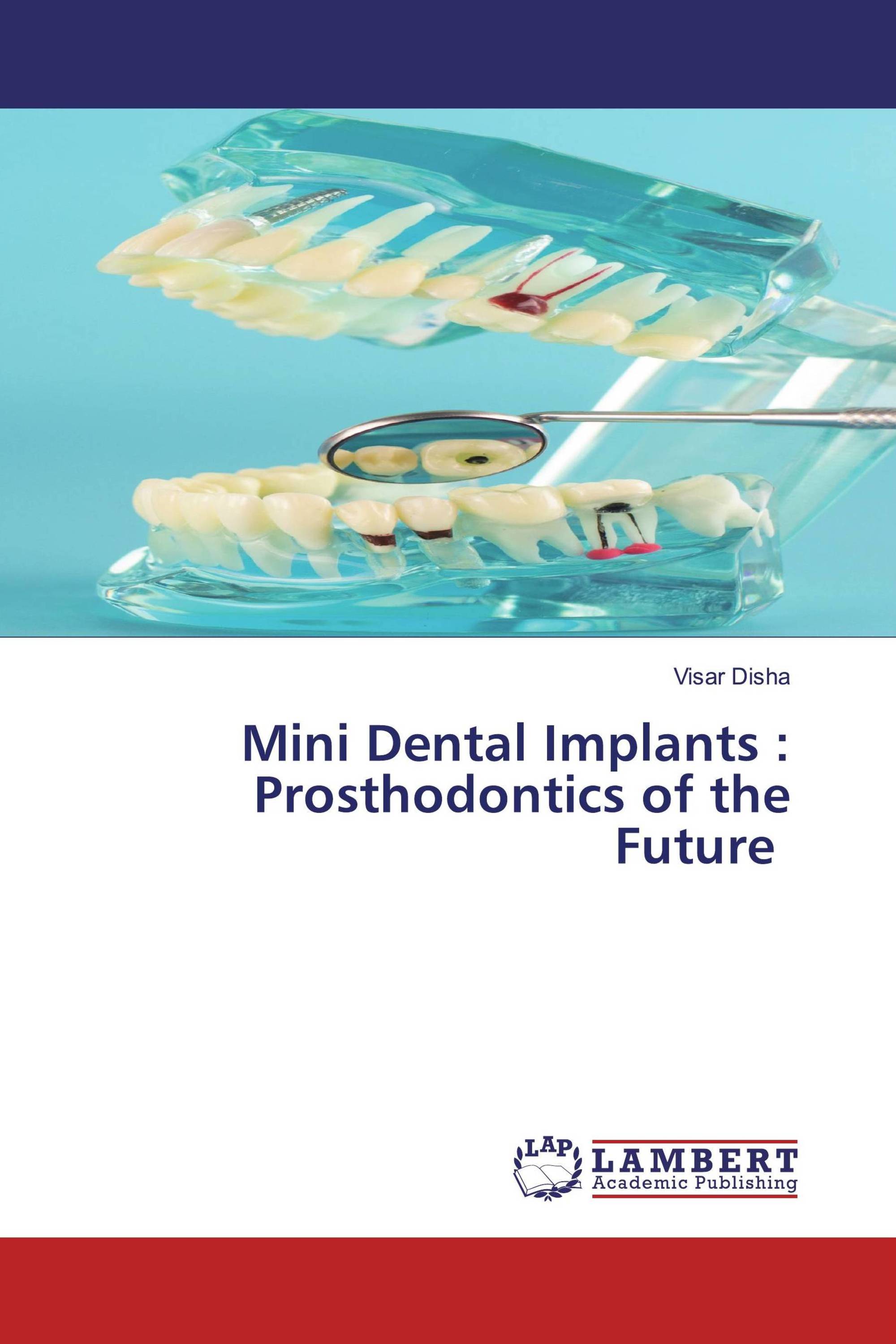 Mini Dental Implants : Prosthodontics of the Future