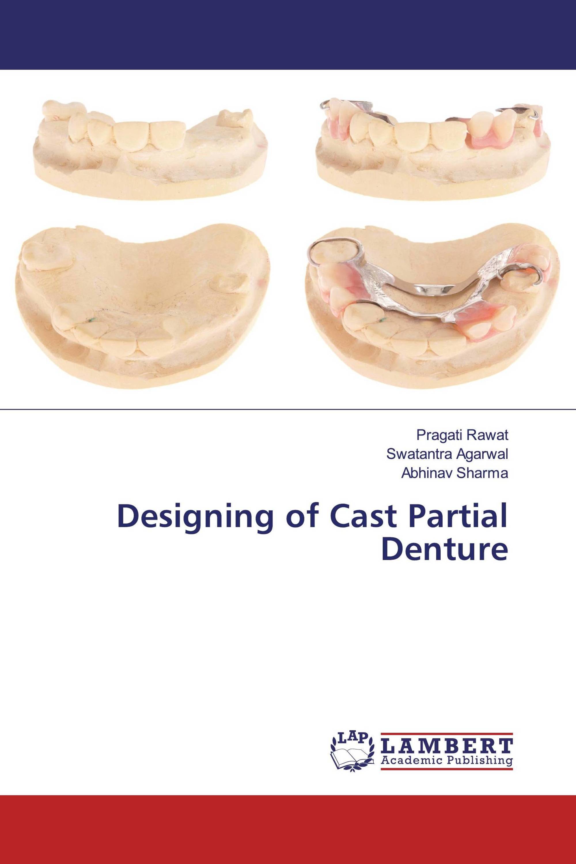 Designing of Cast Partial Denture / 9786202529266 / 9786202529266