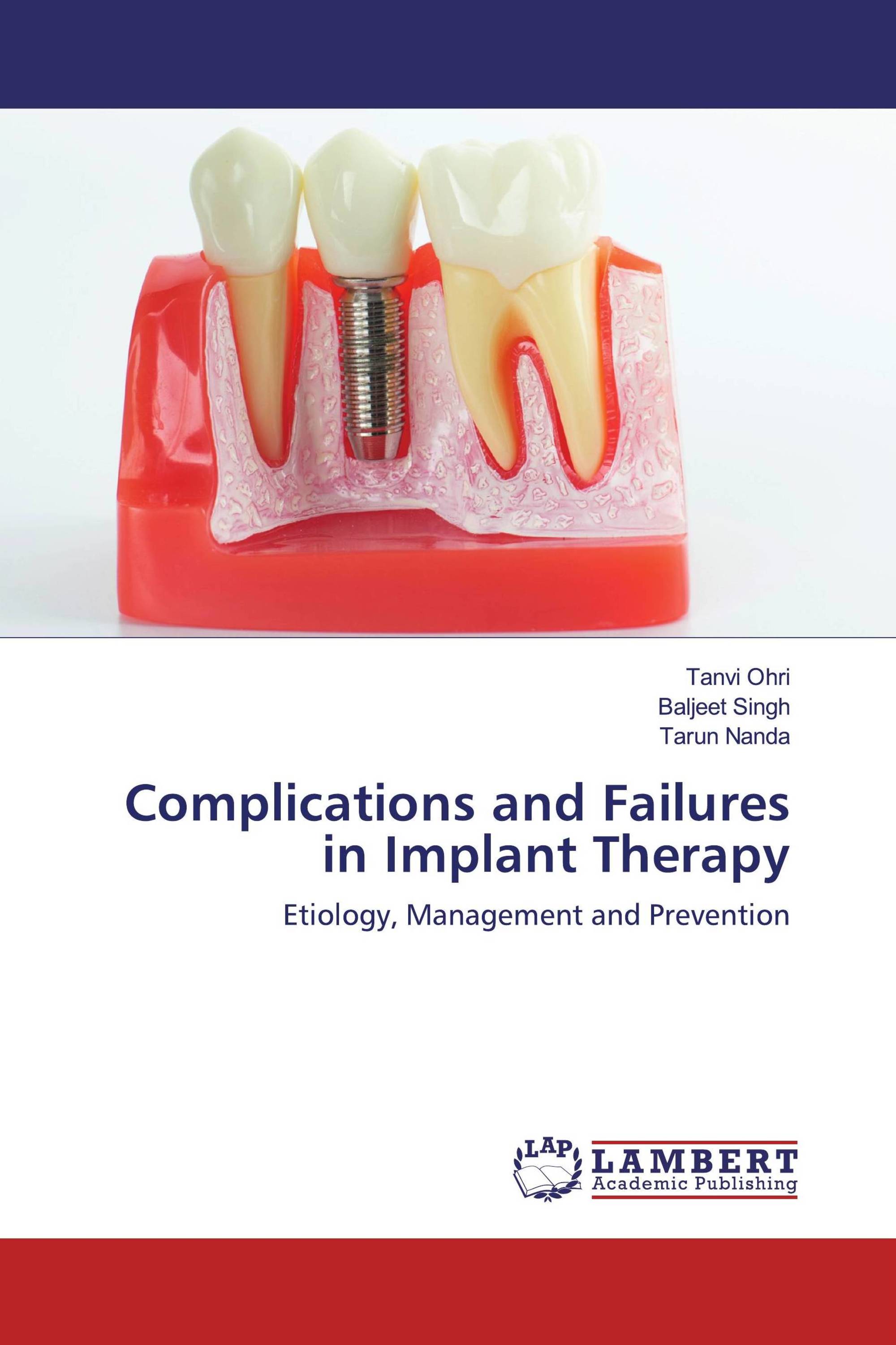 Complications and Failures in Implant Therapy