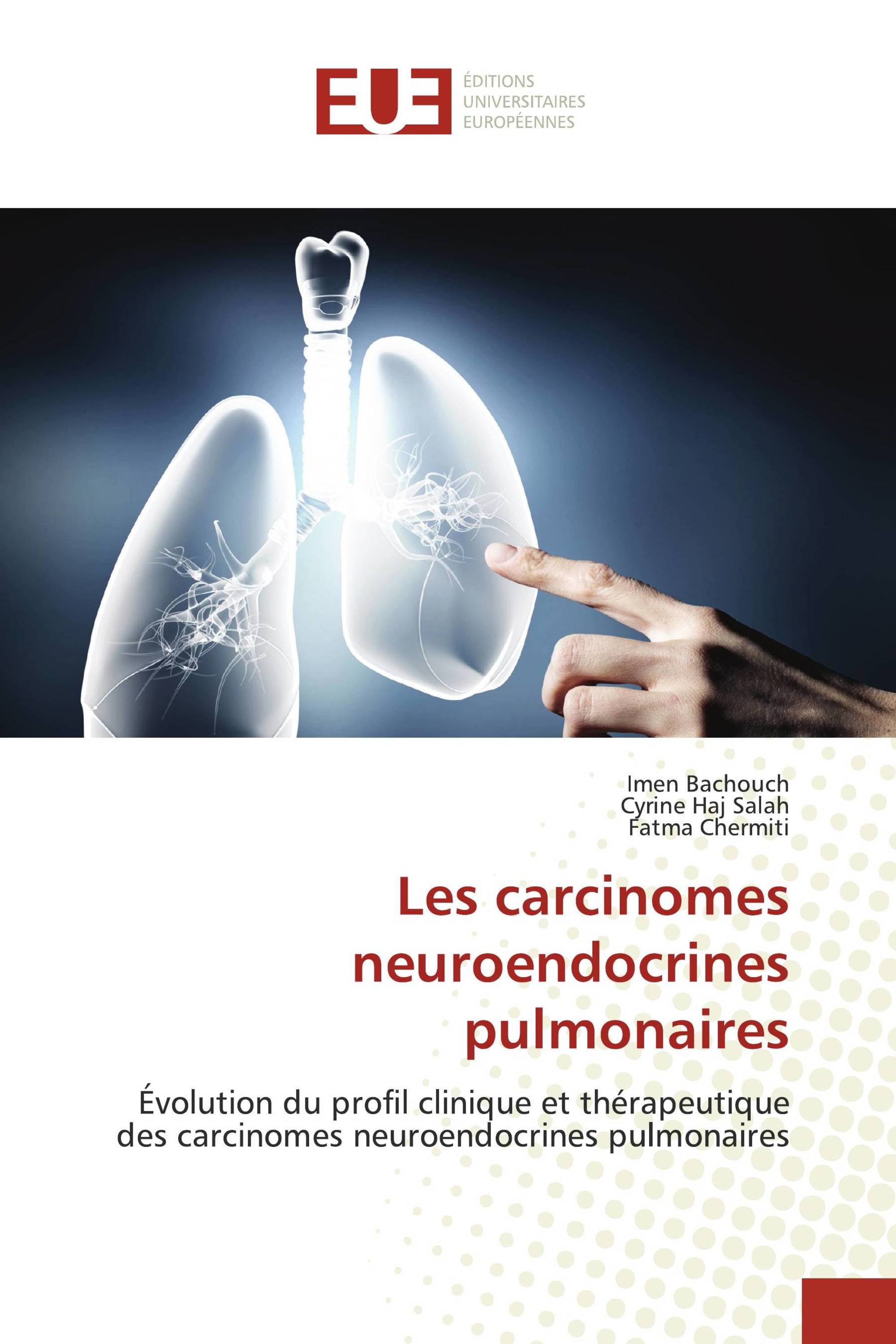 Les carcinomes neuroendocrines pulmonaires