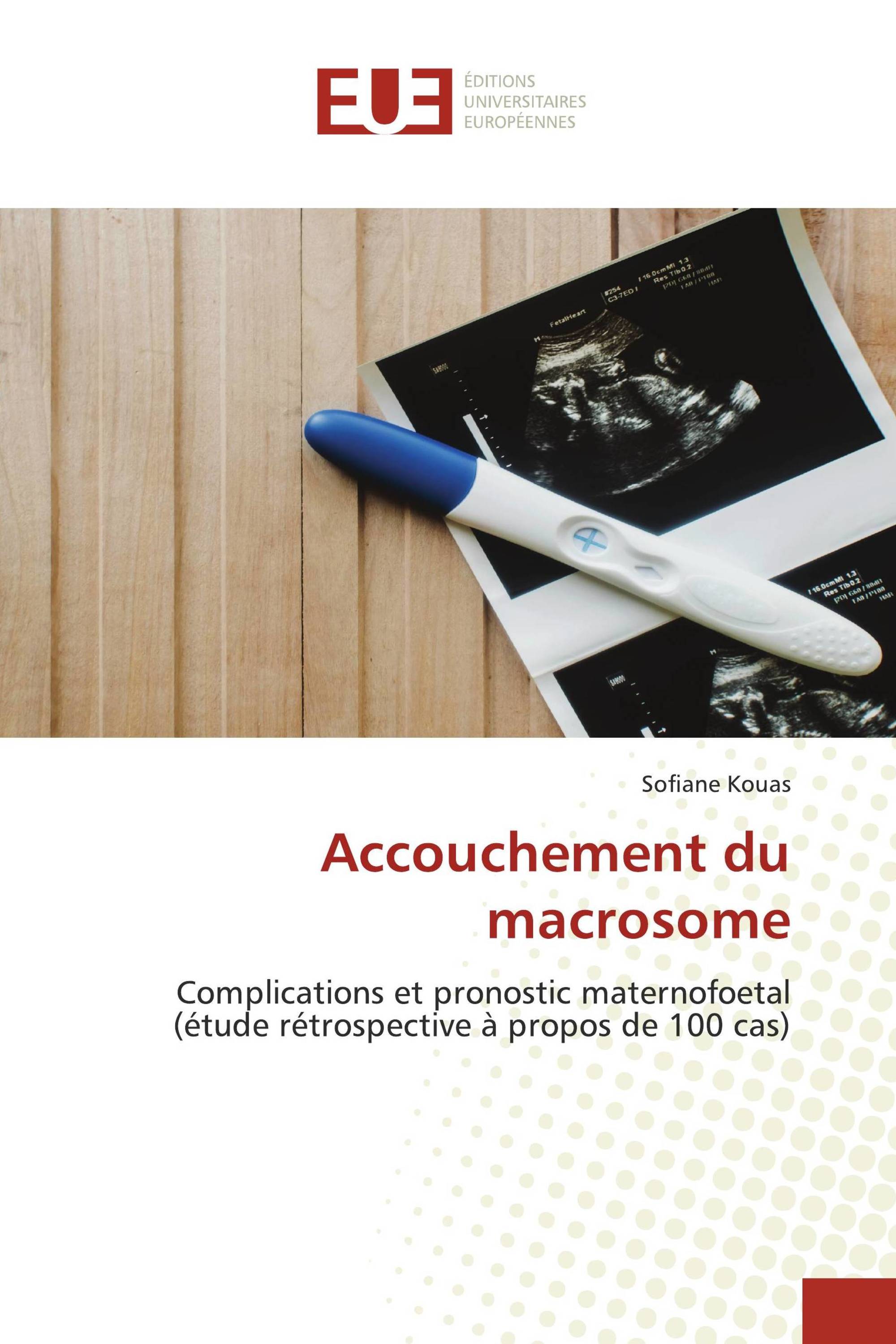 Accouchement du macrosome