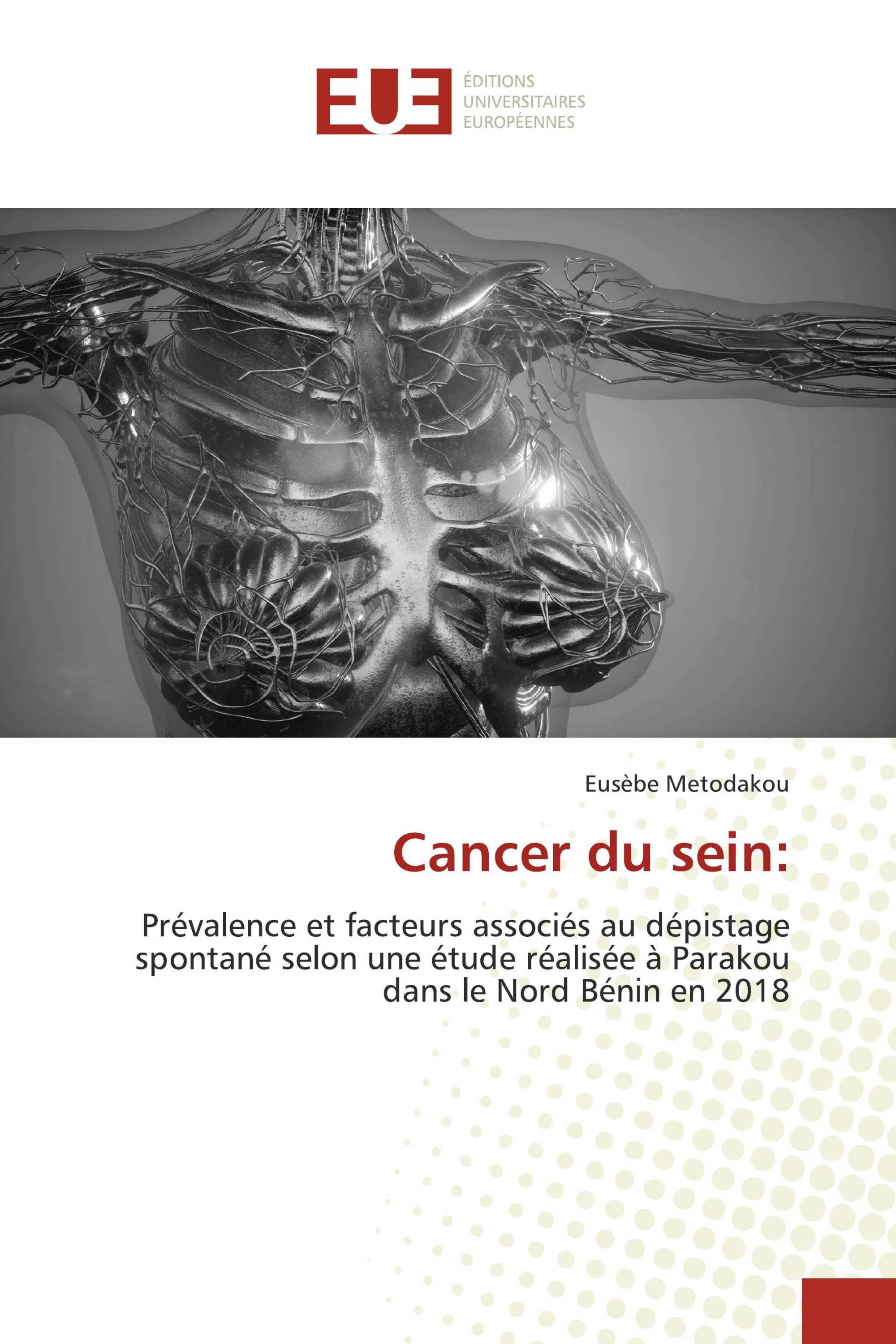 Cancer du sein: