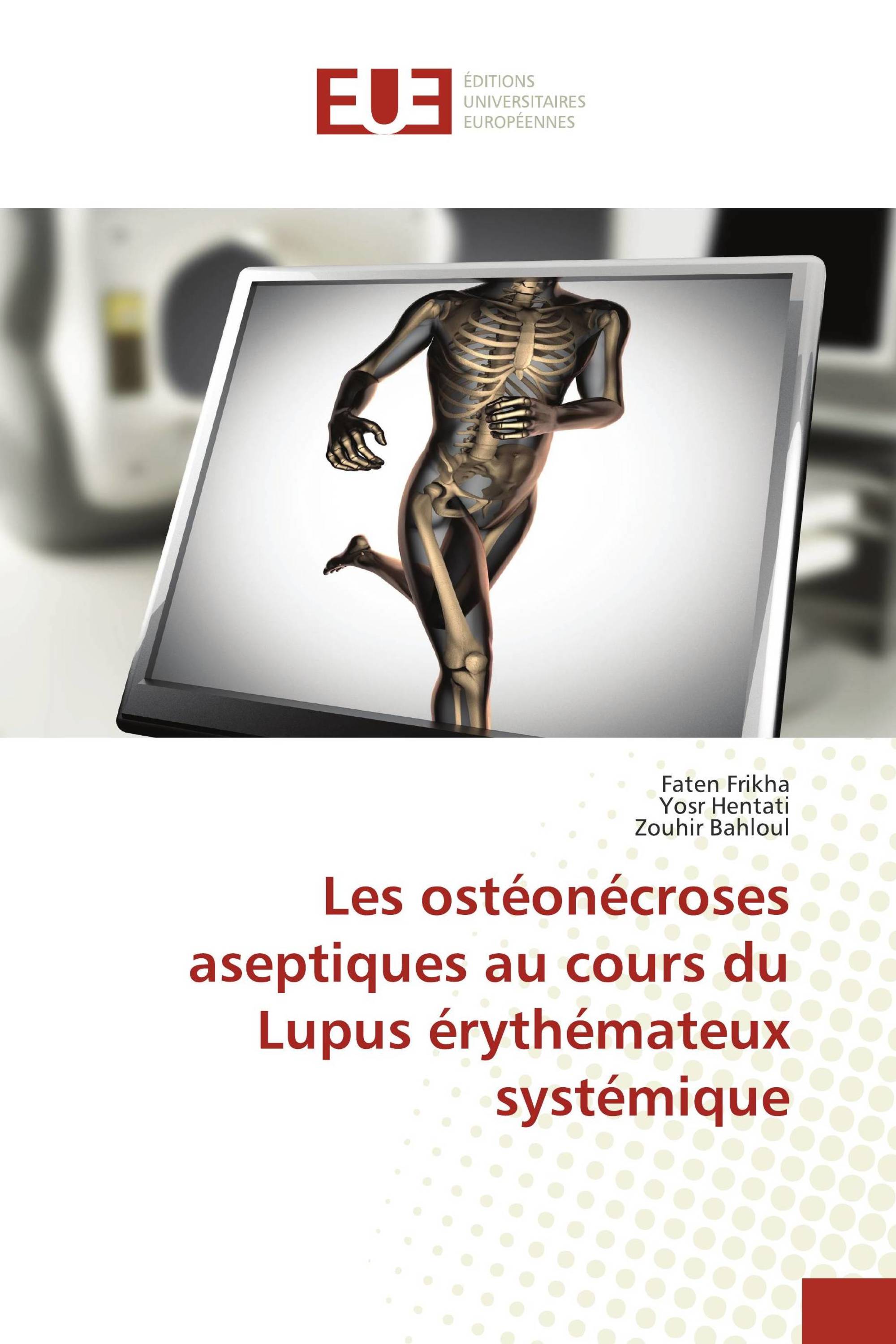 Les ostéonécroses aseptiques au cours du Lupus érythémateux systémique