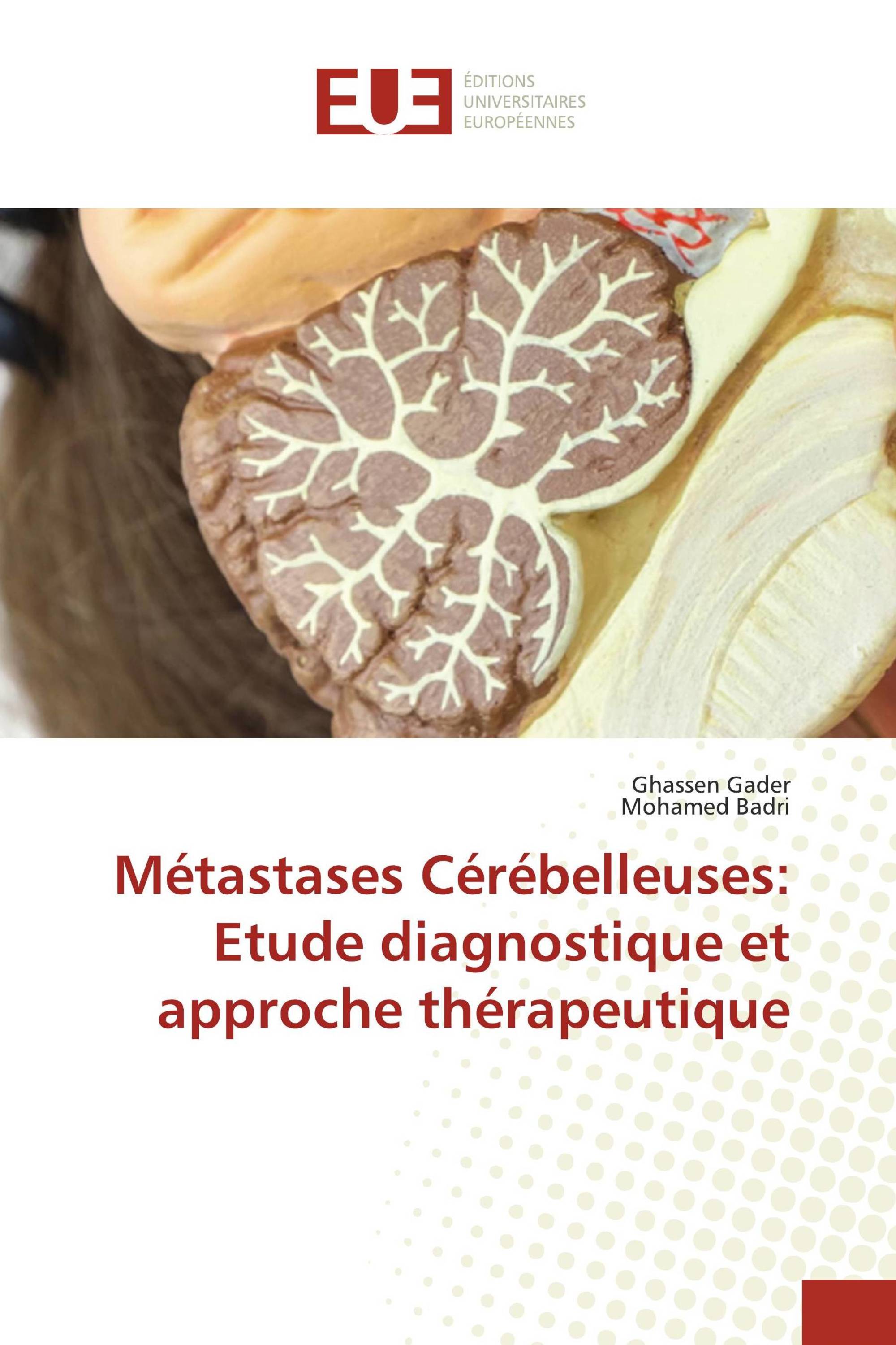 Métastases Cérébelleuses: Etude diagnostique et approche thérapeutique