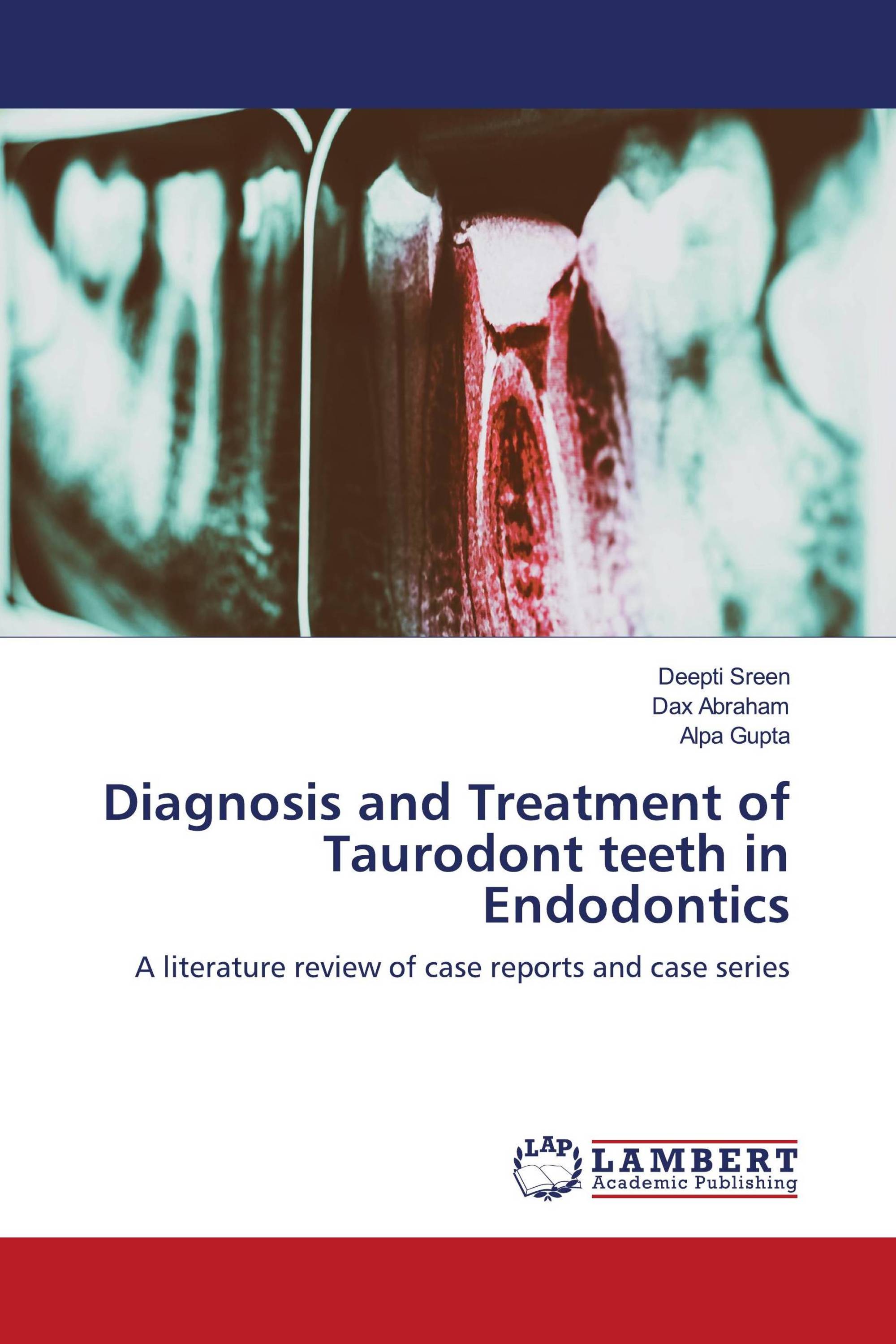 Diagnosis and Treatment of Taurodont teeth in Endodontics