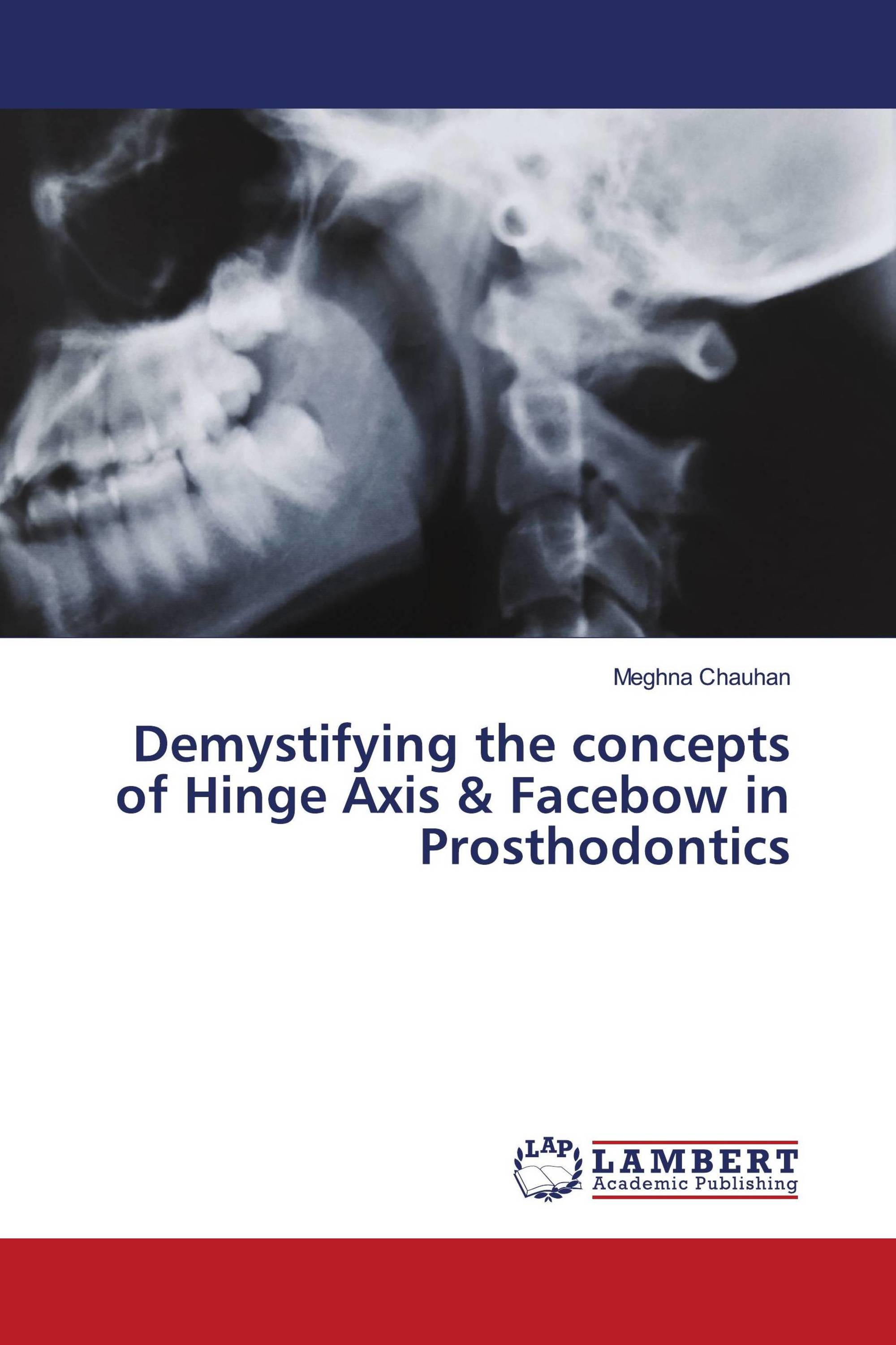 Demystifying the concepts of Hinge Axis & Facebow in Prosthodontics