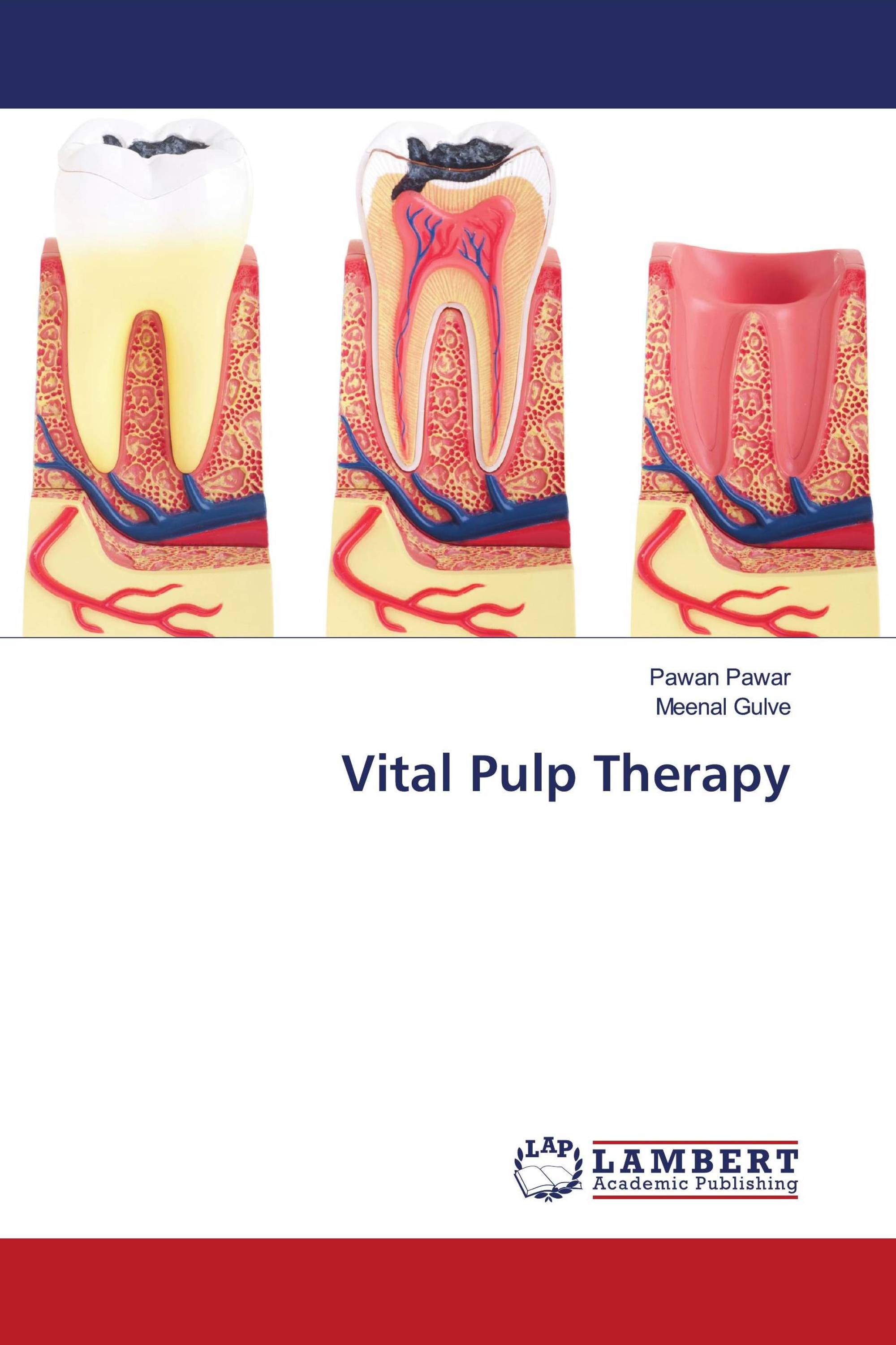 vital-pulp-therapy-978-620-2-67775-2-9786202677752-6202677759