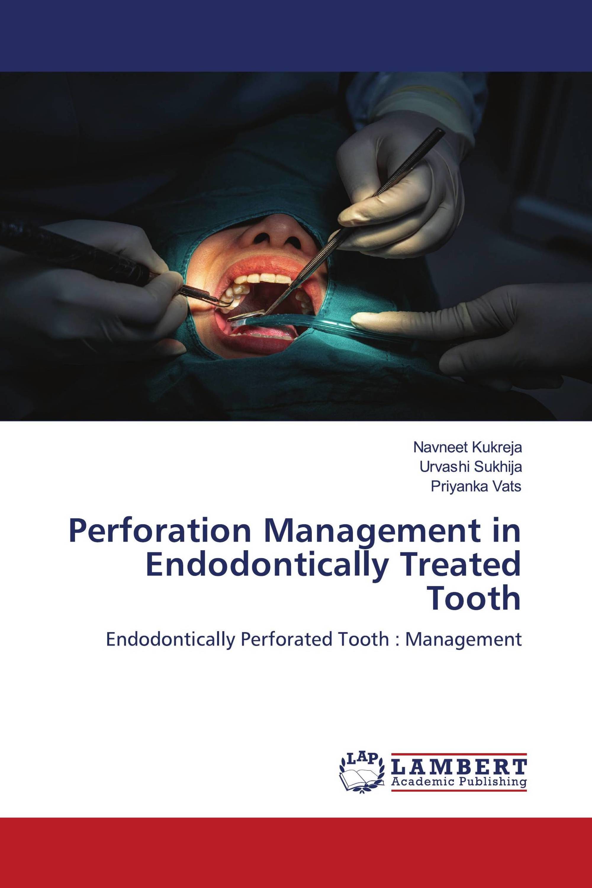 Perforation Management in Endodontically Treated Tooth / 978-620-2 ...