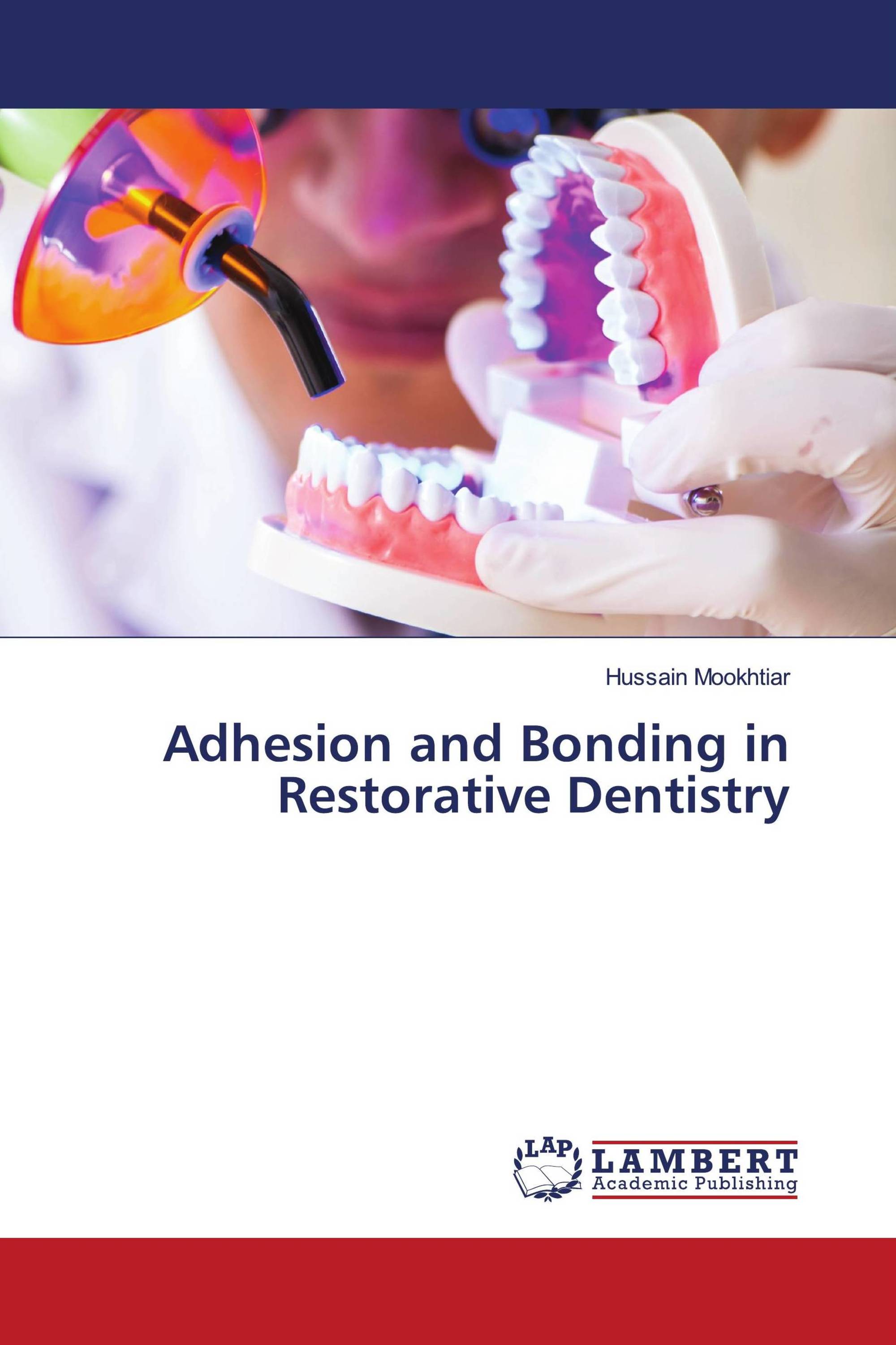 Adhesion And Bonding In Restorative Dentistry / 978-620-2-78871-7 ...