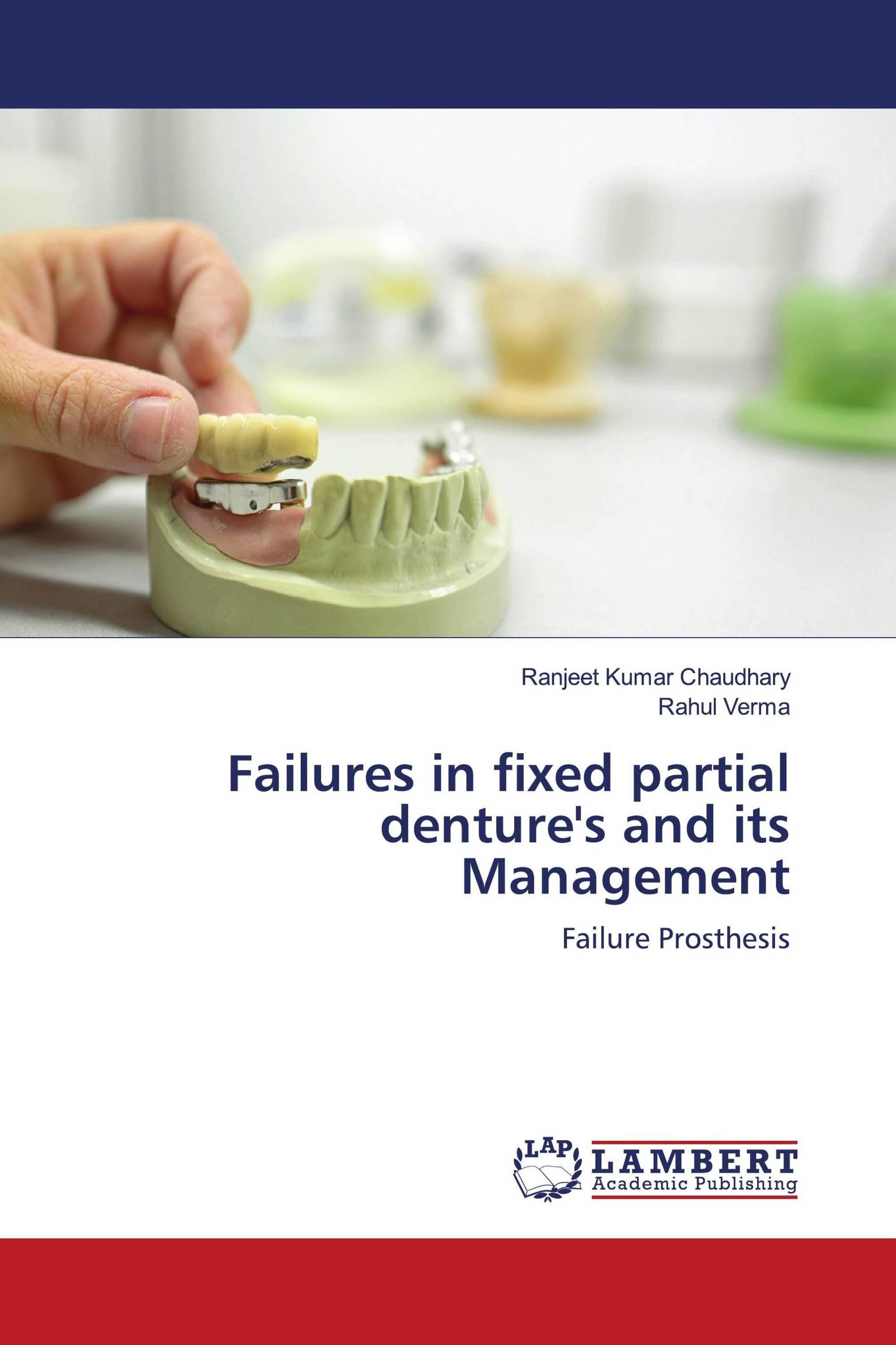 Bridges fixed partial dentures image