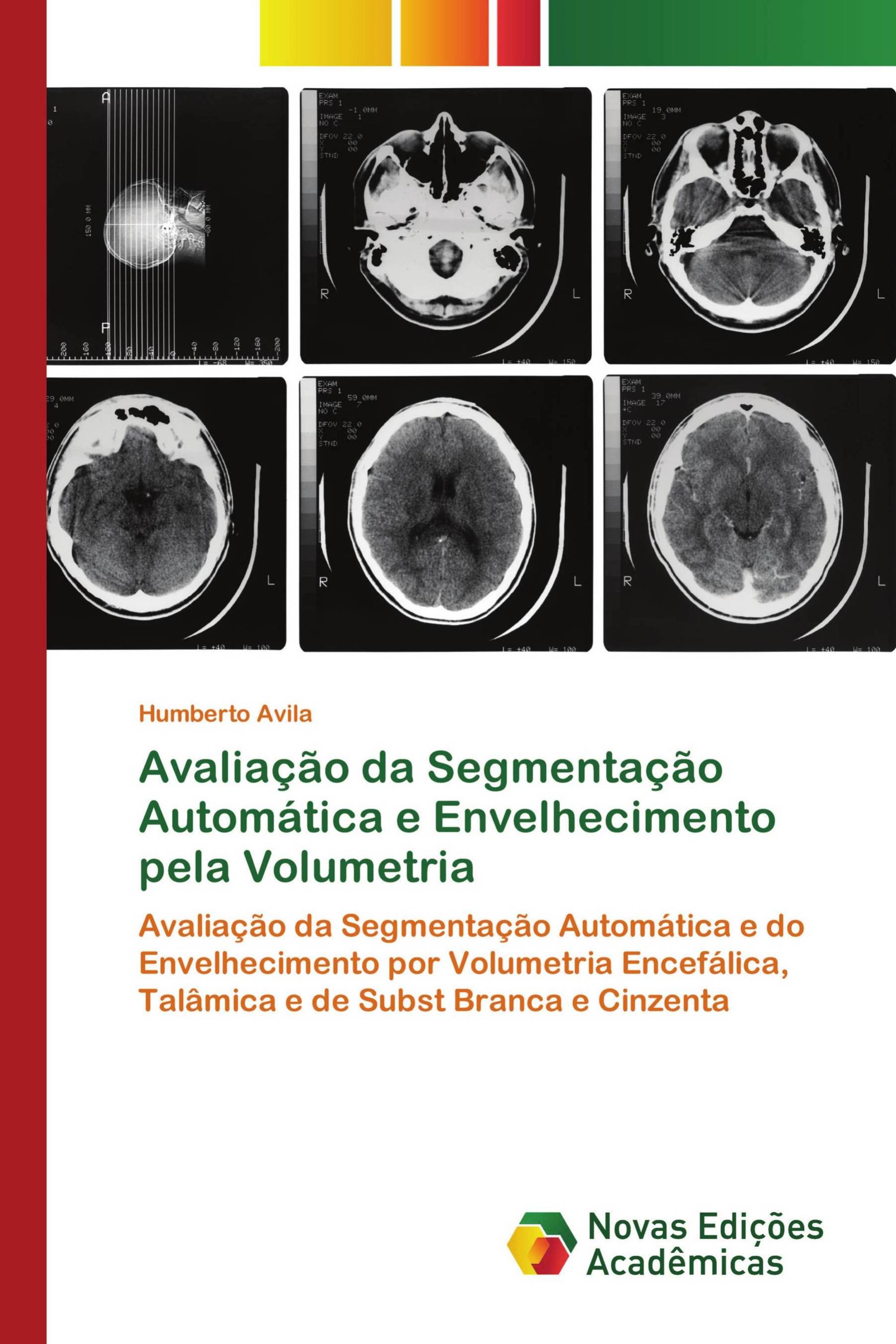 Avaliação da Segmentação Automática e Envelhecimento pela Volumetria