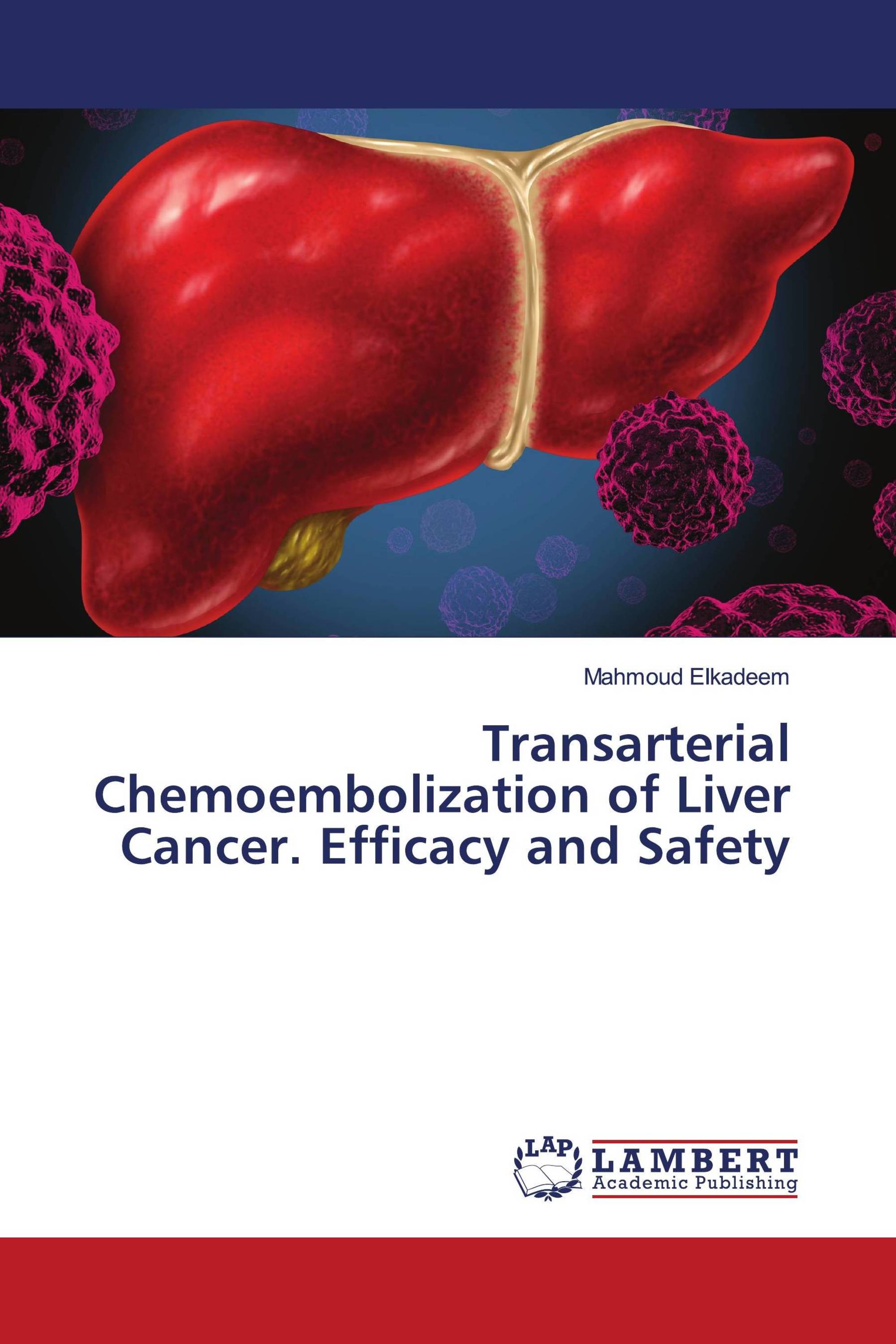 Transarterial Chemoembolization of Liver Cancer. Efficacy and Safety