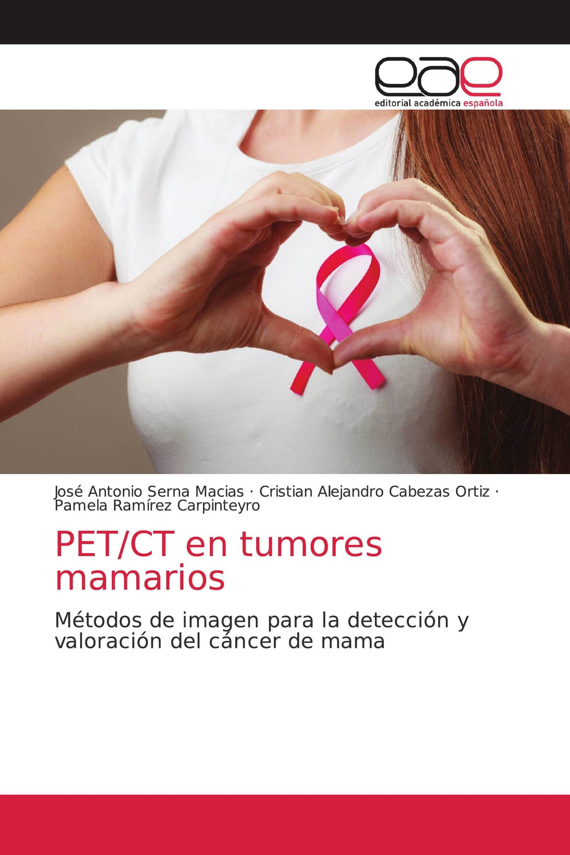 PET/CT en tumores mamarios