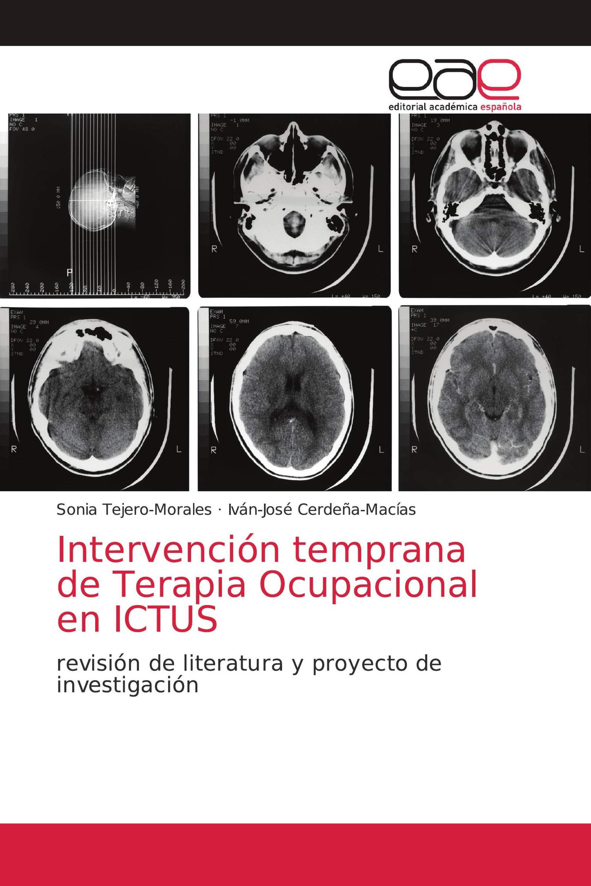 Intervención temprana de Terapia Ocupacional en ICTUS