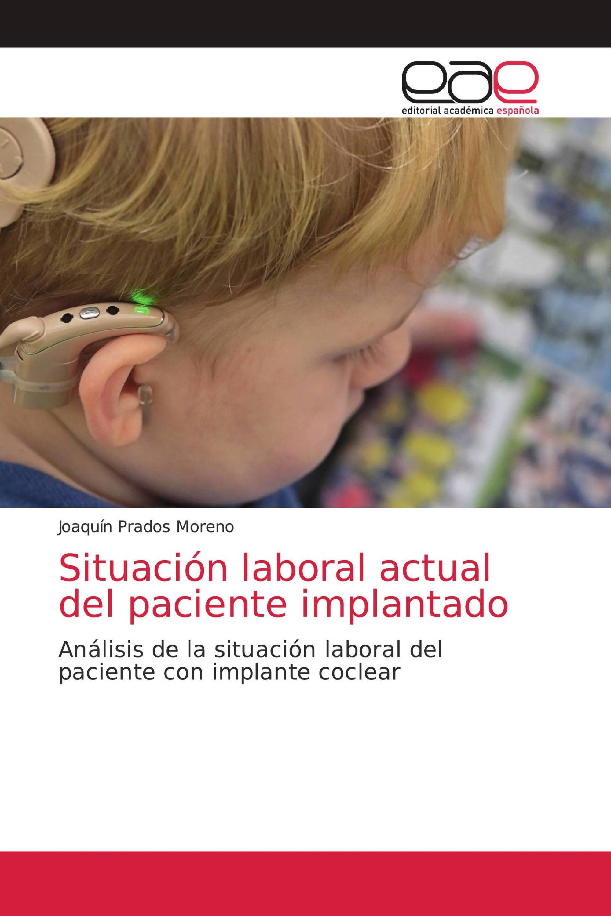 Situación laboral actual del paciente implantado