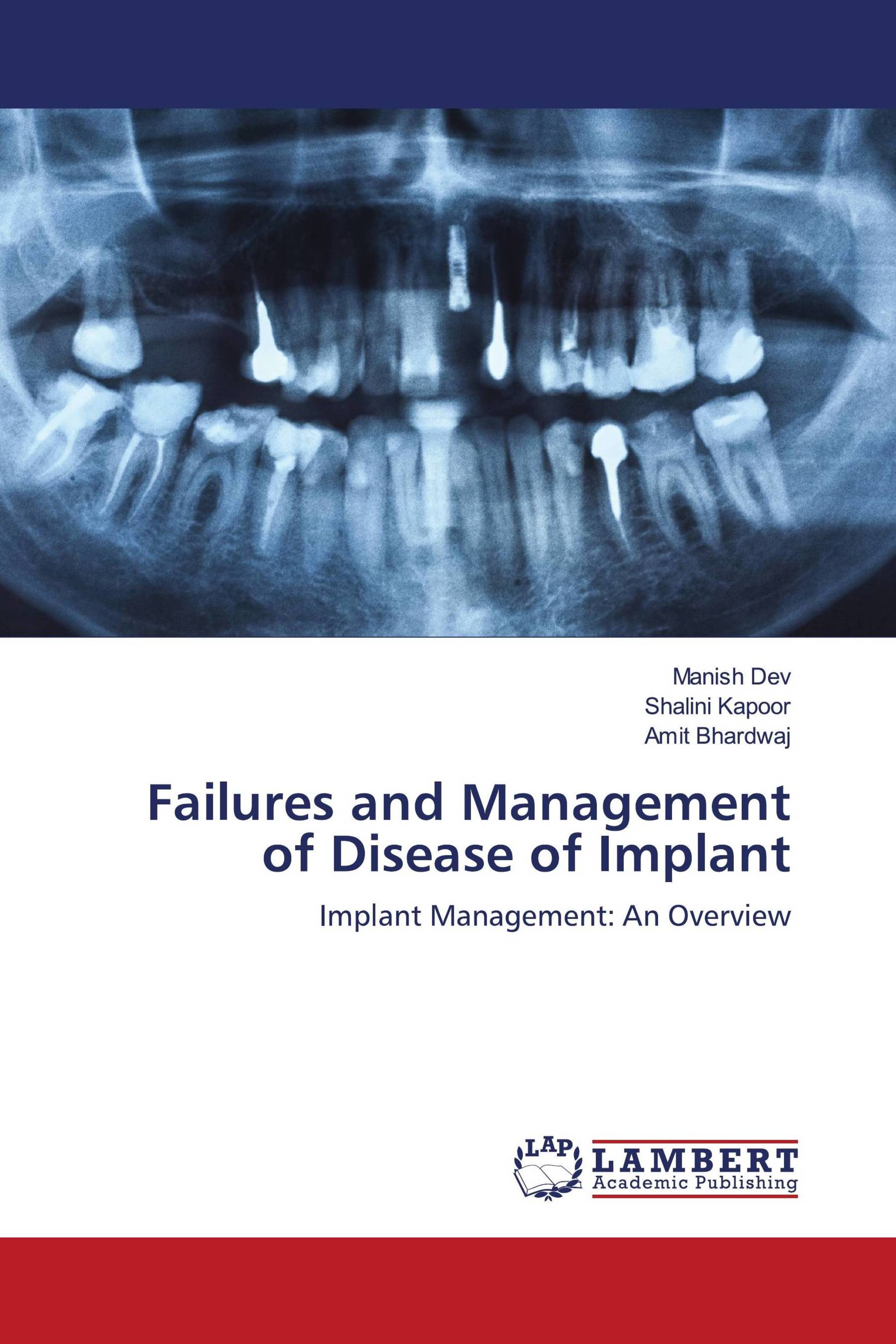 Failures and Management of Disease of Implant