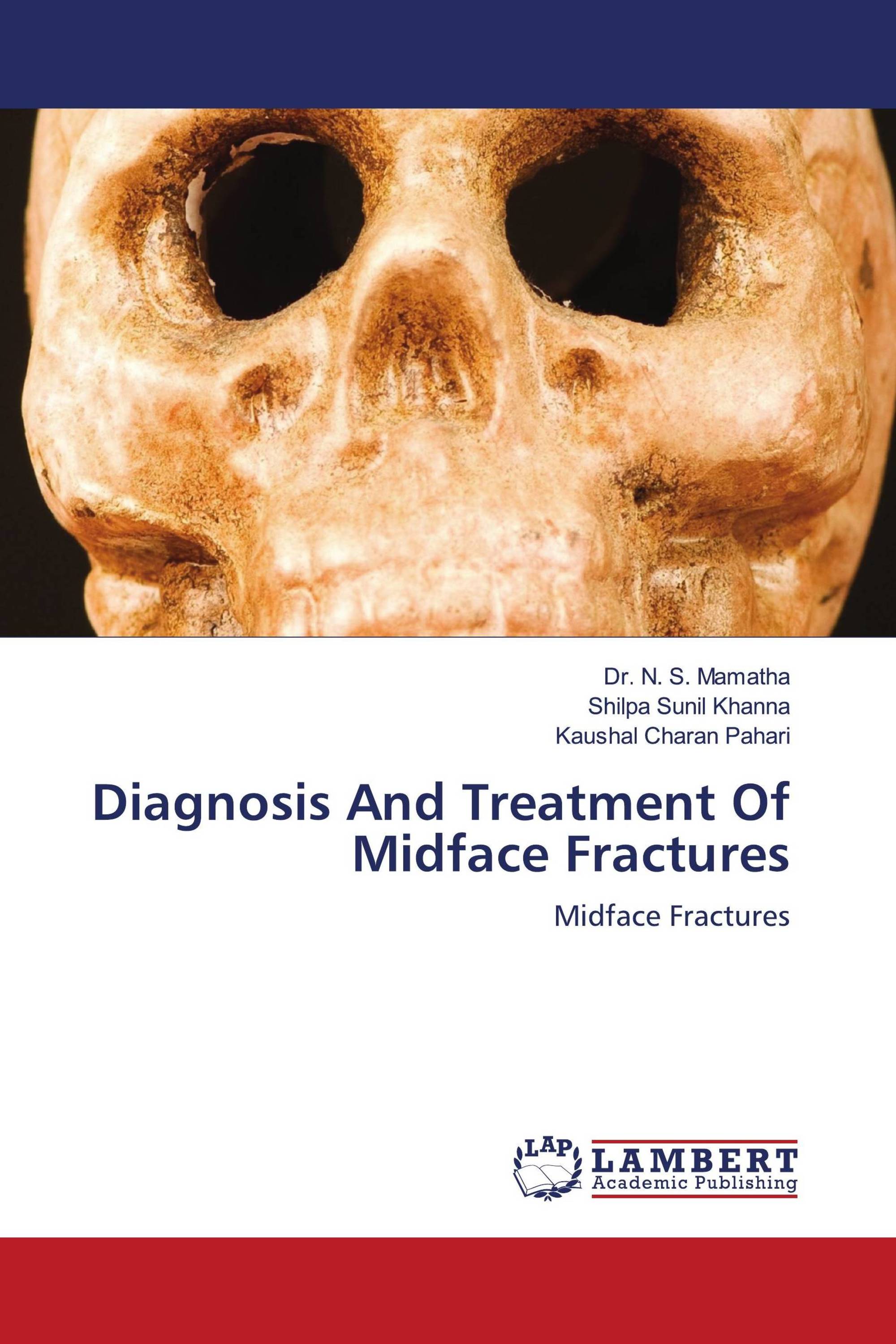 Diagnosis And Treatment Of Midface Fractures