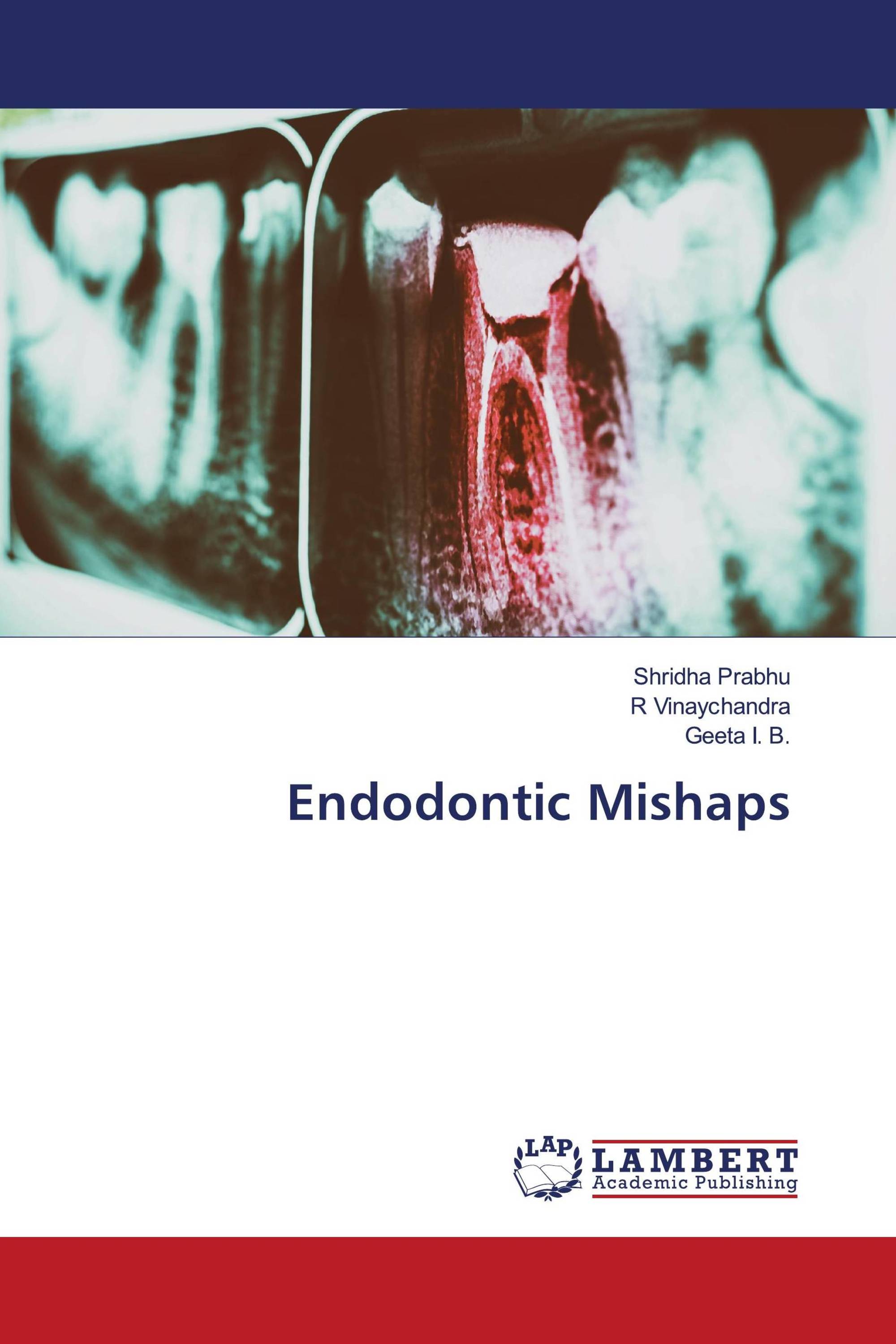 Endodontic Mishaps