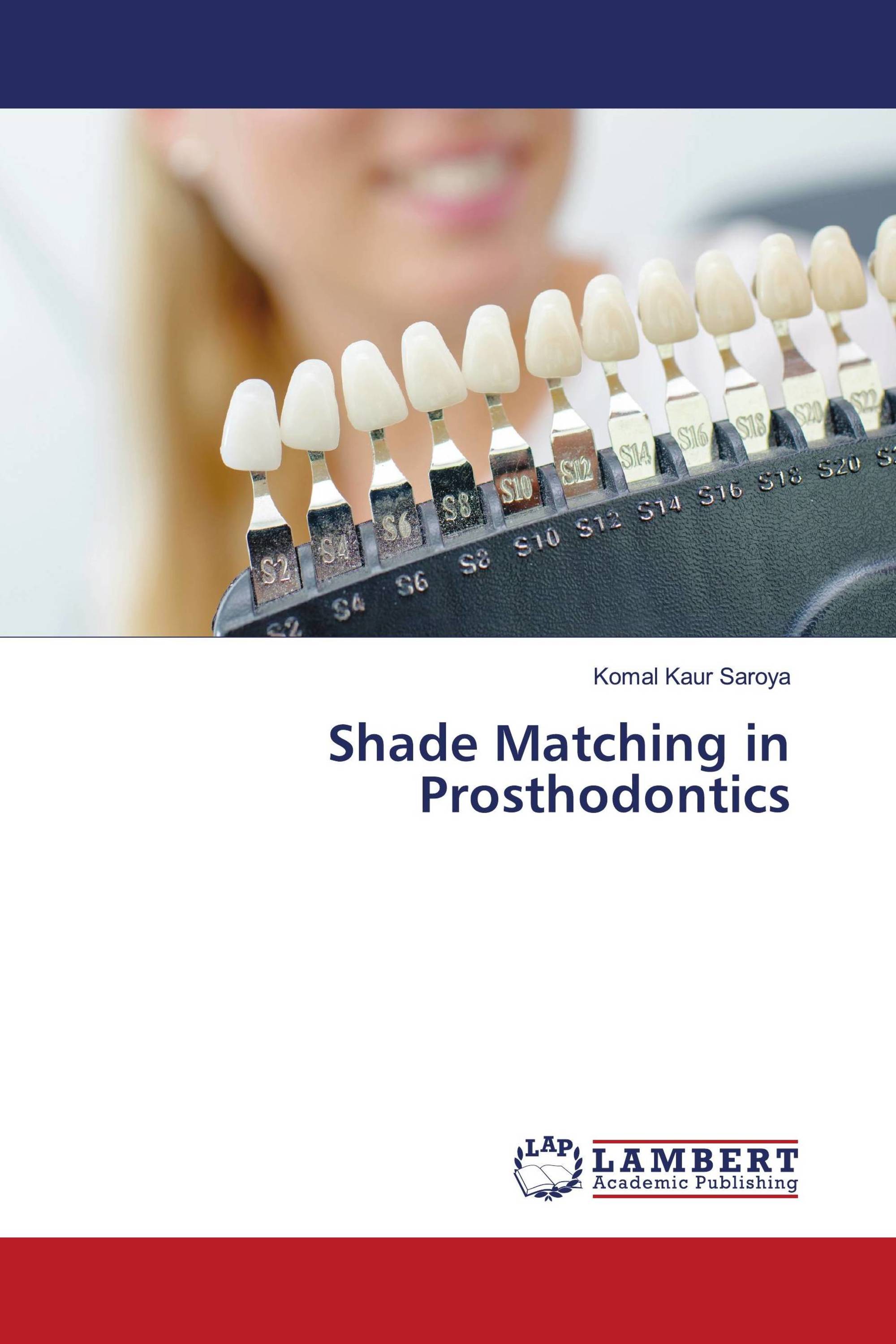 Shade Matching in Prosthodontics