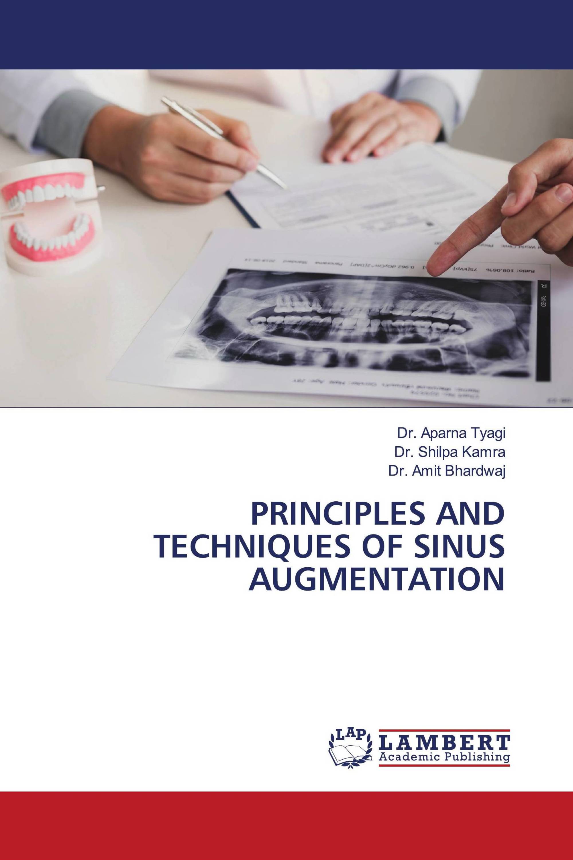 PRINCIPLES AND TECHNIQUES OF SINUS AUGMENTATION