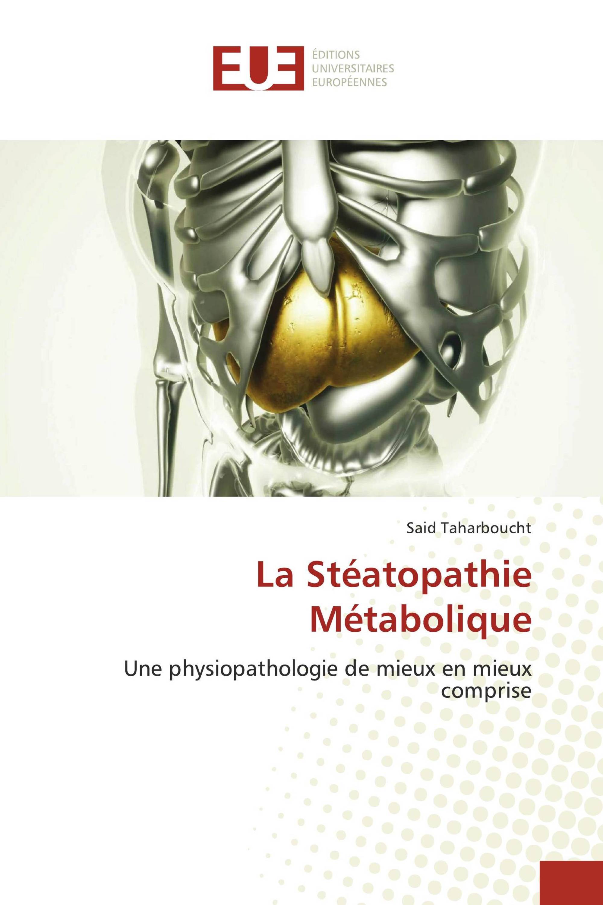 La Stéatopathie Métabolique