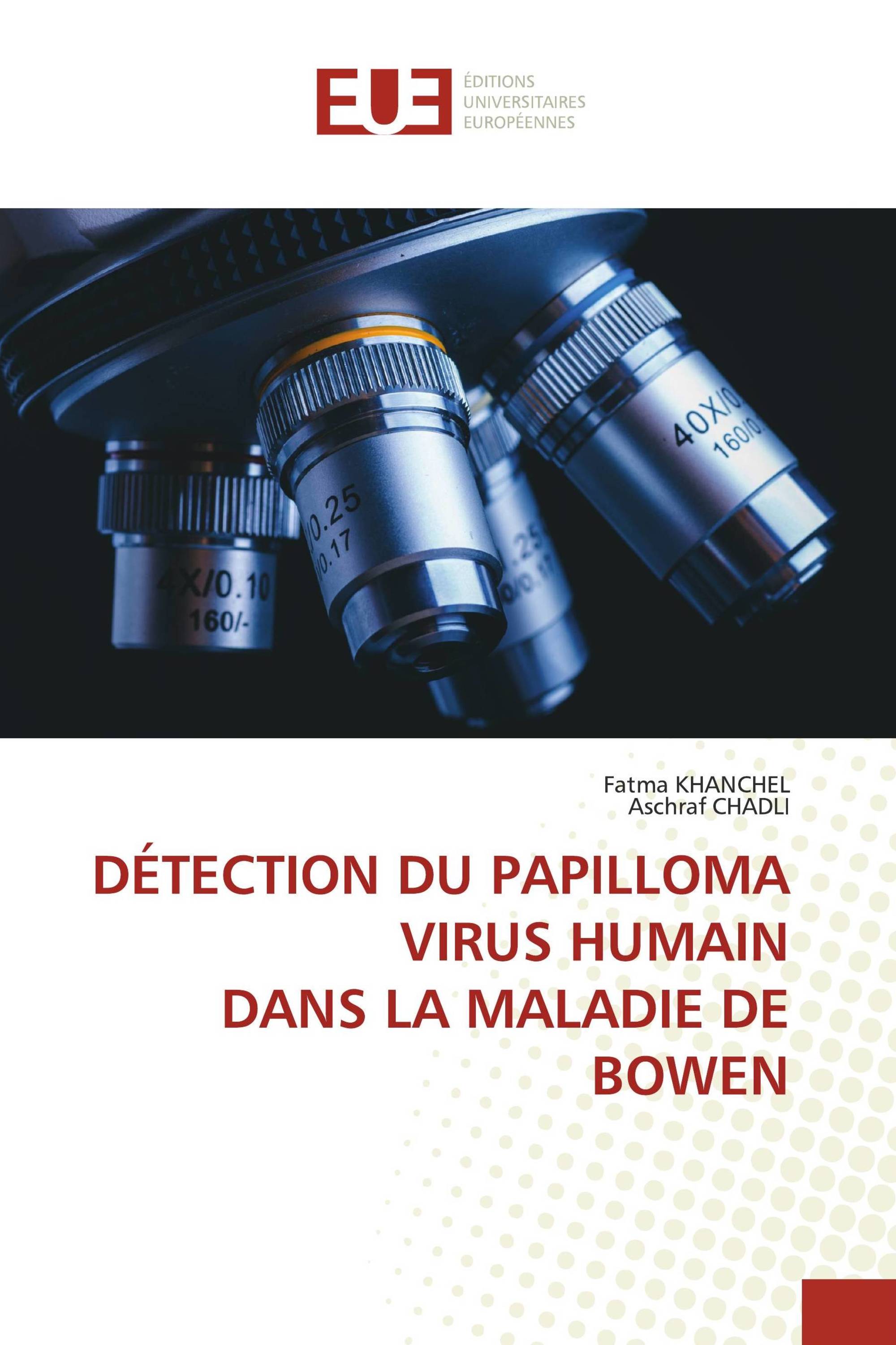 DÉTECTION DU PAPILLOMA VIRUS HUMAIN DANS LA MALADIE DE BOWEN