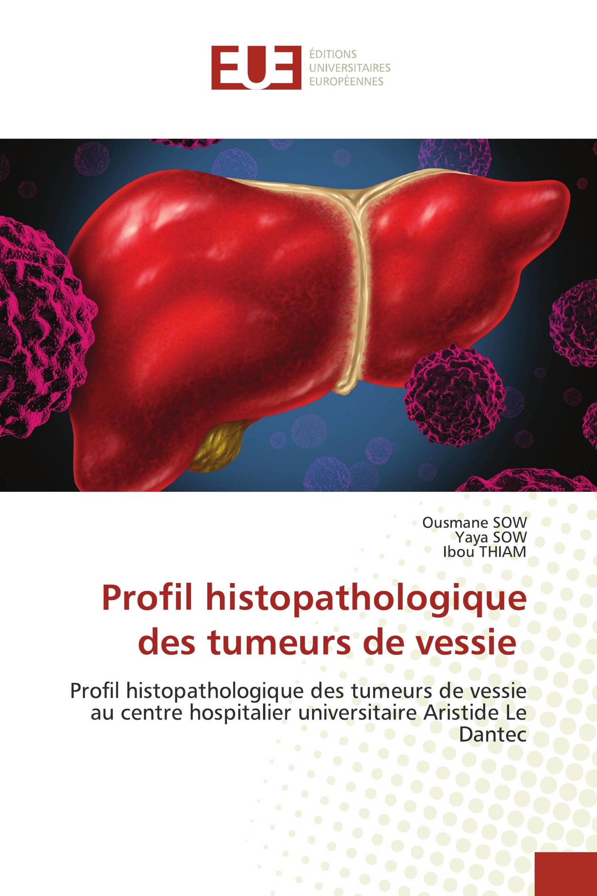 Profil histopathologique des tumeurs de vessie