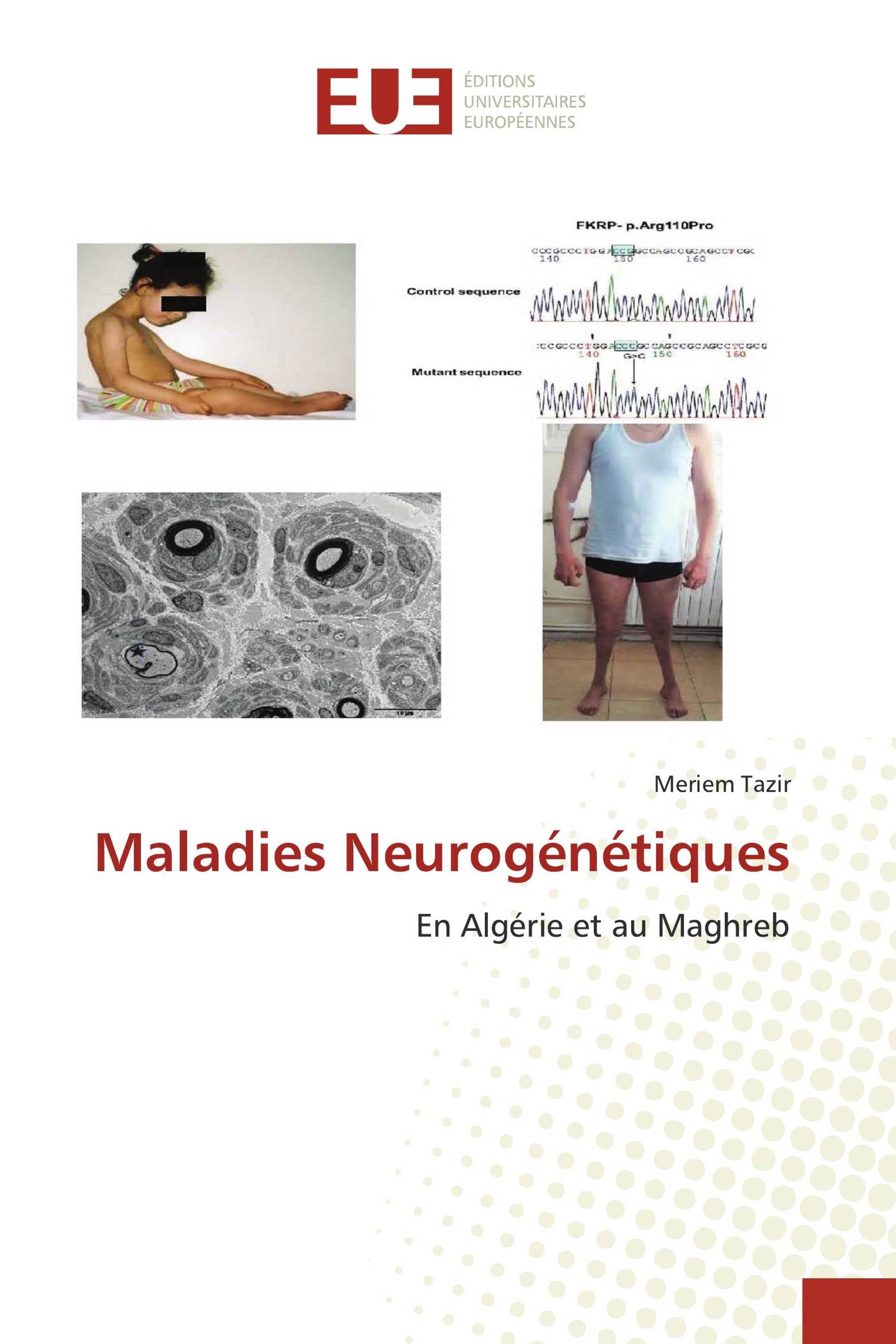 Maladies Neurogénétiques
