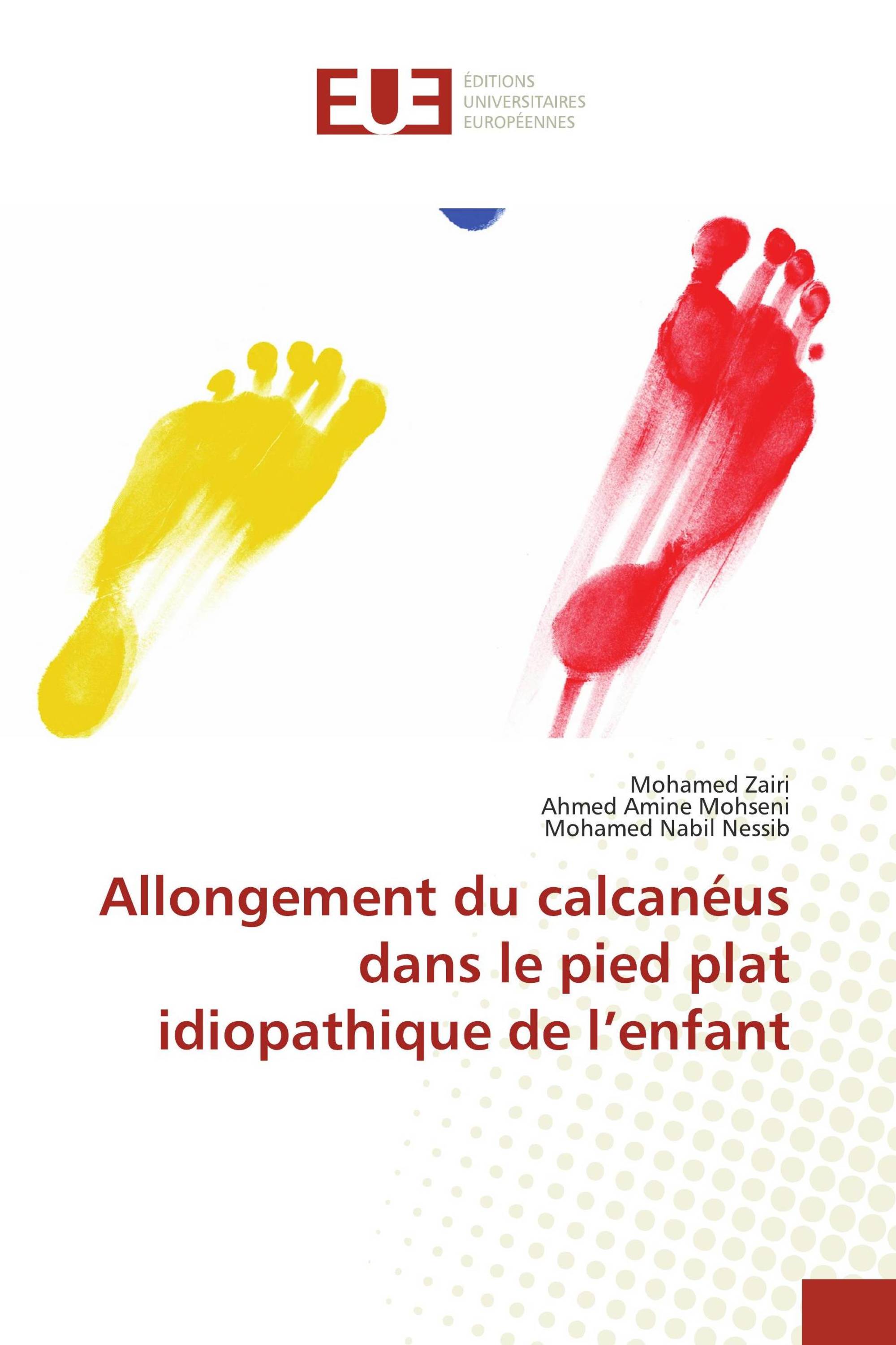 Allongement du calcanéus dans le pied plat idiopathique de l’enfant