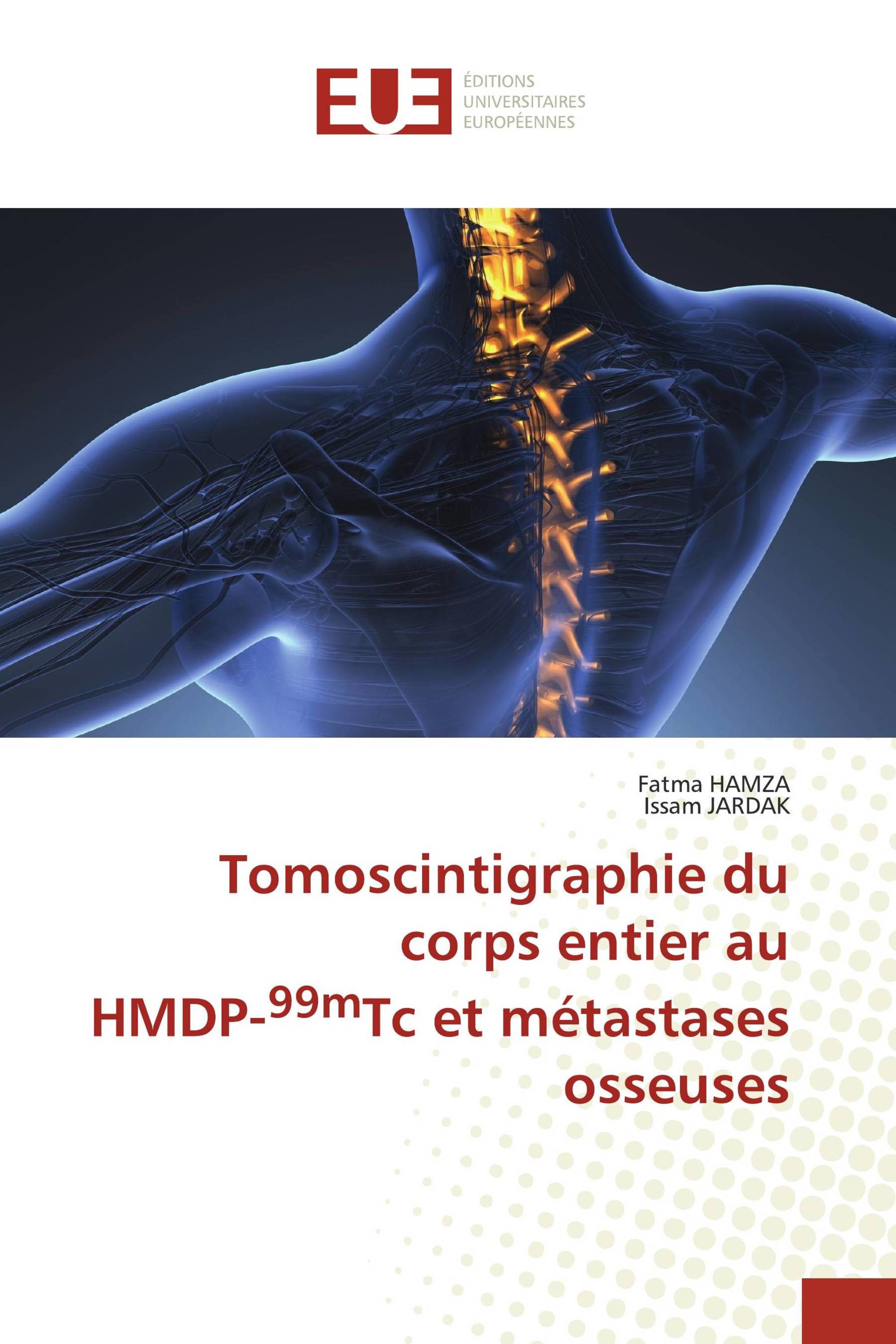 Tomoscintigraphie du corps entier au HMDP-99mTc et métastases osseuses