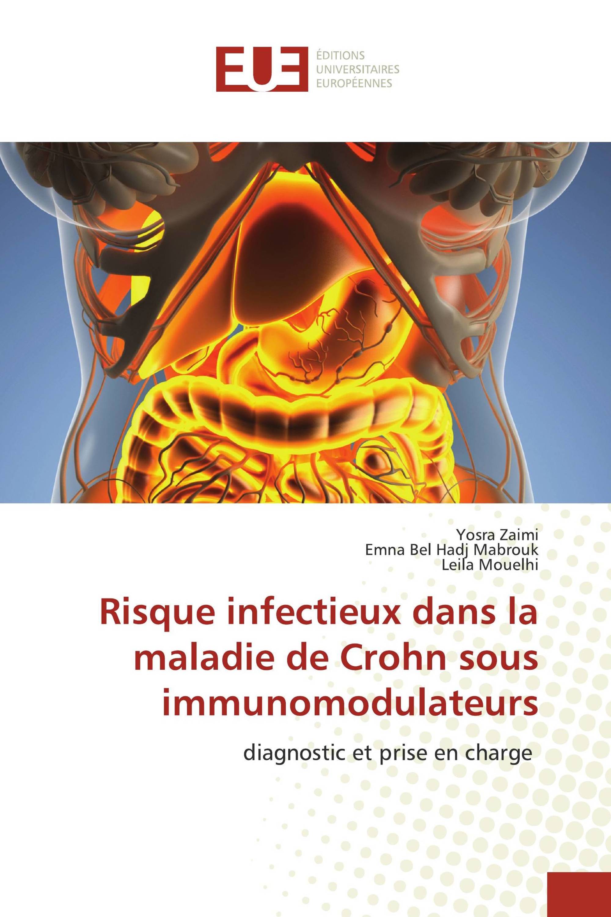 Risque infectieux dans la maladie de Crohn sous immunomodulateurs