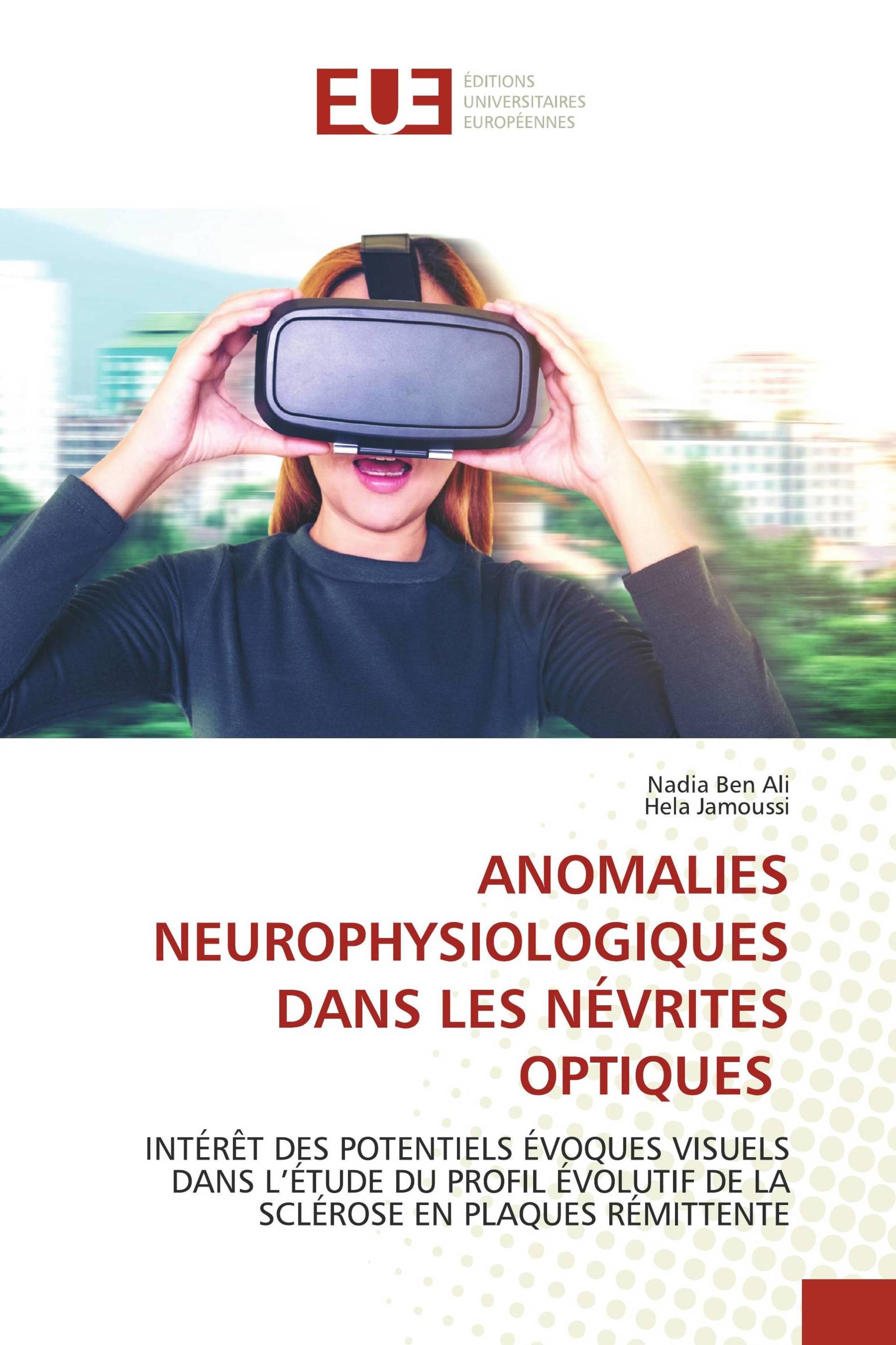 ANOMALIES NEUROPHYSIOLOGIQUES DANS LES NÉVRITES OPTIQUES / 978-620 ...
